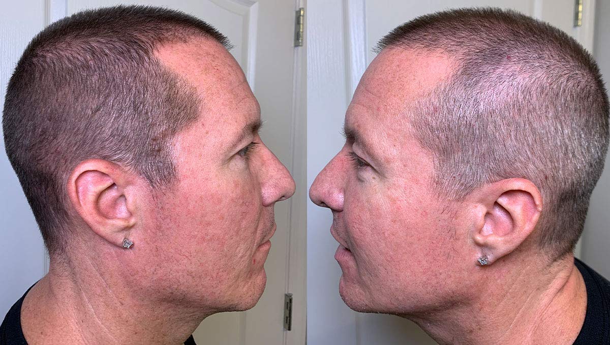 Thicken It Scalp Coverage: Dark Brown