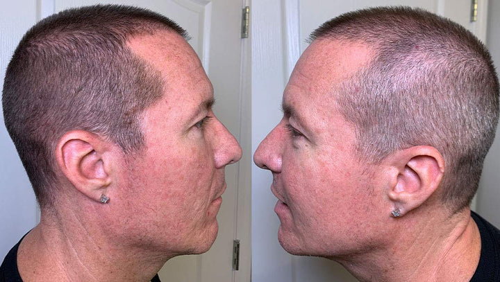 Thicken It Scalp Coverage: Dark Brown