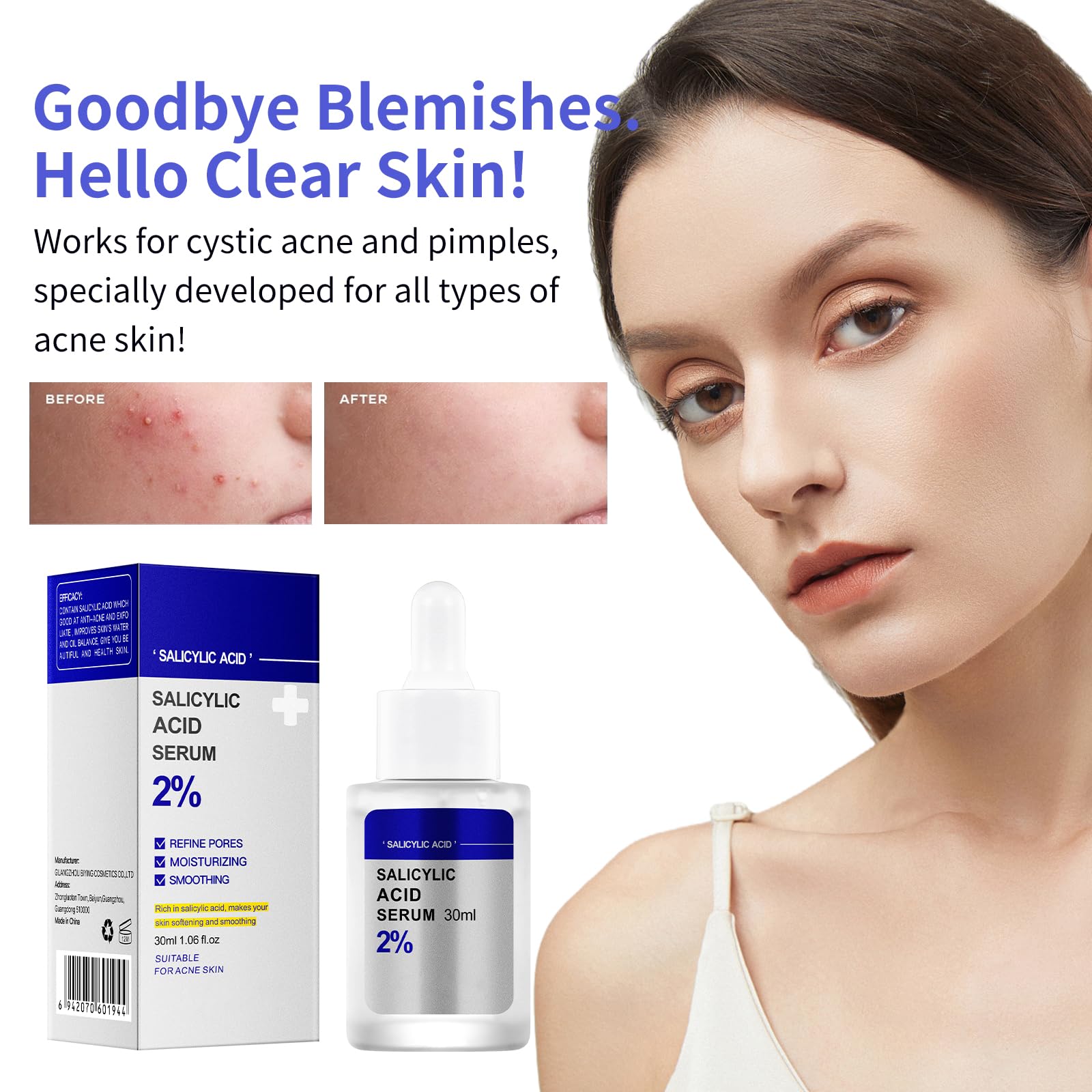 Salicylic Acid Acne Treatment for Face, Salicylic Acid Face Serum Solution Spot Treatment Pore Minimizer Anti Acne Products for Adults and Teens Cystic Hormonal Severe for Women Men Pimpel Breakout