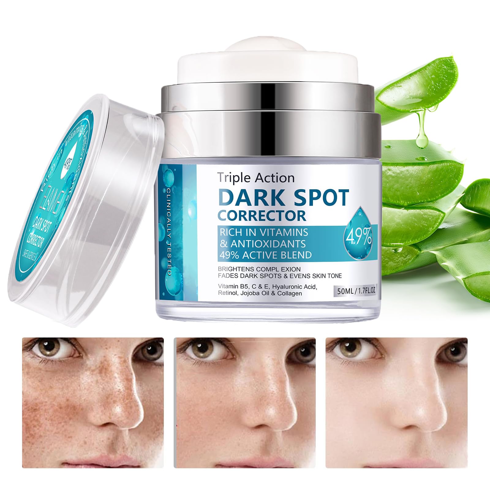 Crema para Manchas Oscuras en La Cara, Cremas para Quitar Manchas de La Cara, 50 ML / 1.7 FLOZ