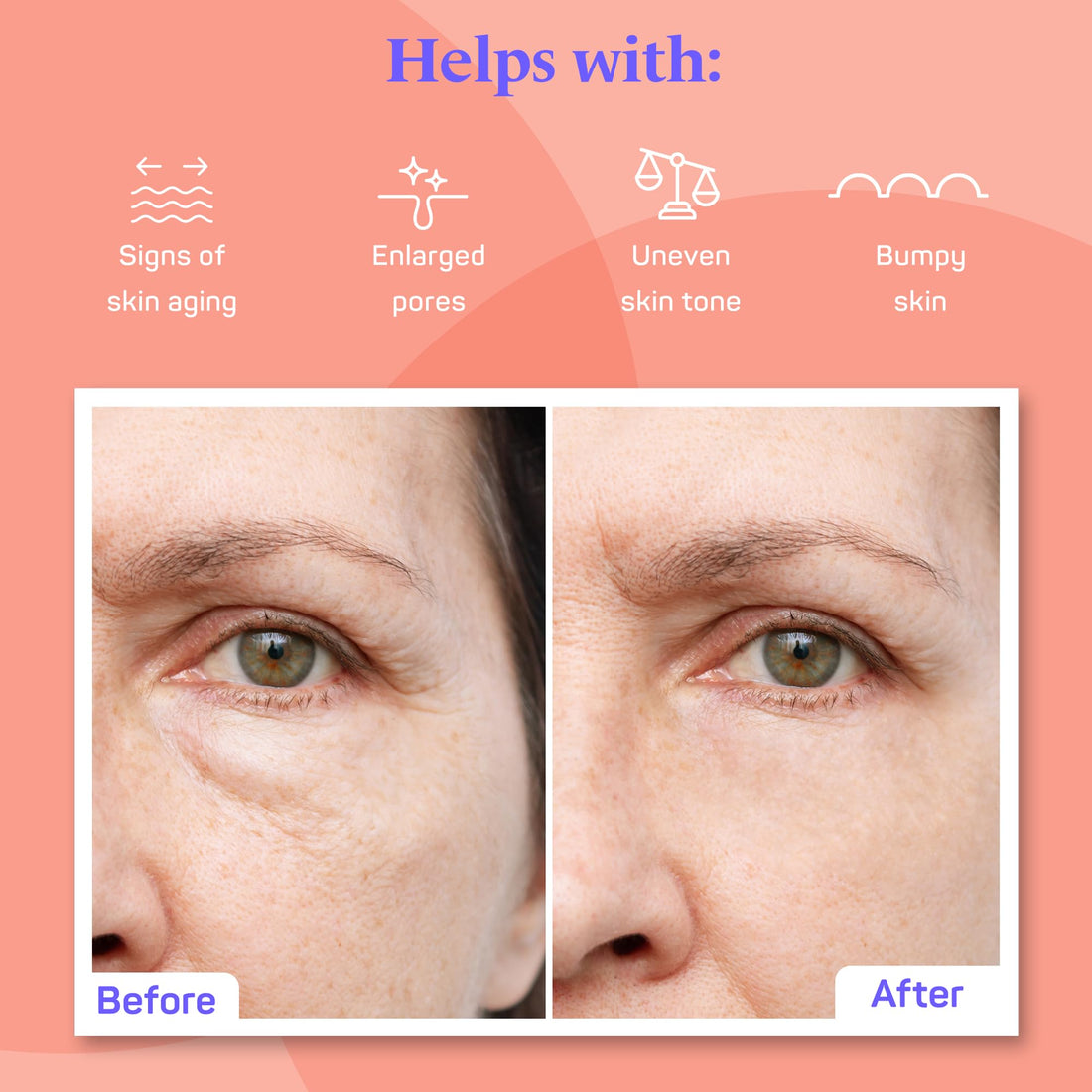 Pure Retinol Creamy Serum LARGE 2oz with Hyaluronic Acid and Vitamin E | Pure Retinol Serum For Face - Unmatched G3L Delivery System - Moisturizer | Serum | Retinol | Made in USA - 2 fl oz/59.4 ml