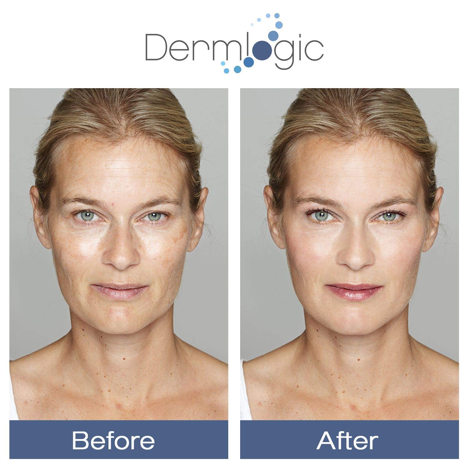 Glycolic Cream 15% - Natural Anti Aging Exfoliator to Smooth Away Fine Lines & Wrinkles & Improve a Dull Looking Complexion. Includes A.H.A & Green Tea Moisturizer for Face & Body.