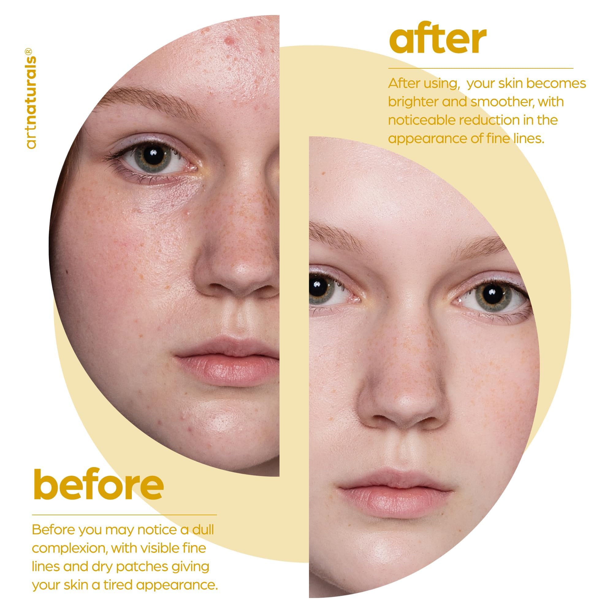 artnaturals Lactic Acid plus AHA Face Serum for Brightening Boost with Renewing Formula - Scars, Acne, Wrinkles - Exfoliates and Moisturizes the Skin - 1 oz.