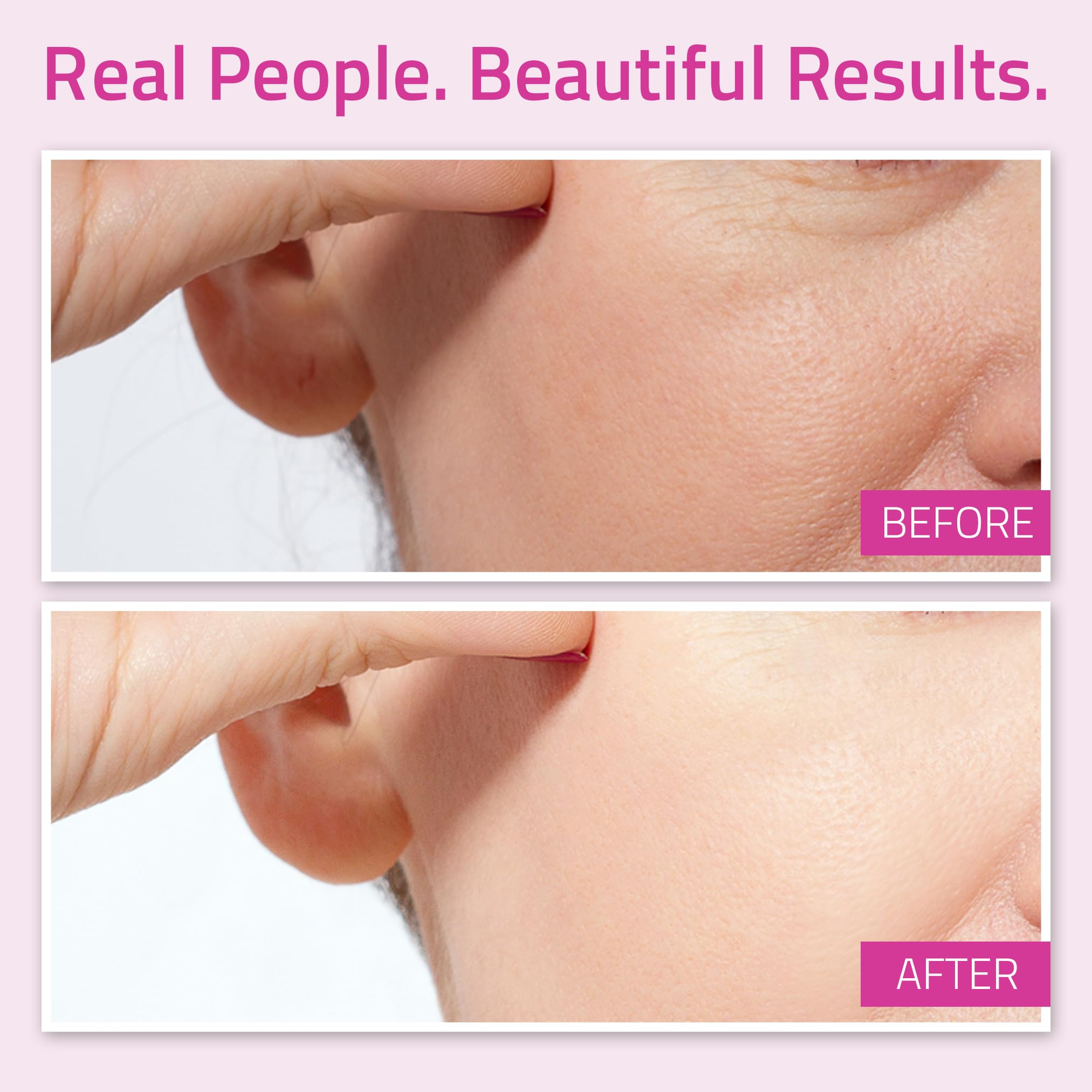 Best Anti-aging Moisturizer With New Patented L22 From YEOUTH