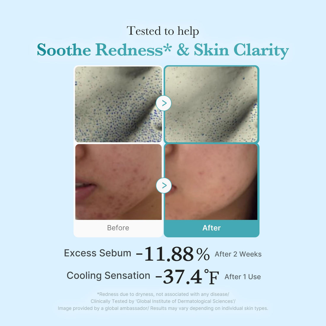 medicube Azelaic Acid Niacinamide Clarifying Toner | Troubled Skin Care, Ideal for Purifying & Calming | 4% Azelaic Acid & 2% Niacinamide| Soothing Daily Toner | Korean Skin Care | 8.45 fl.oz