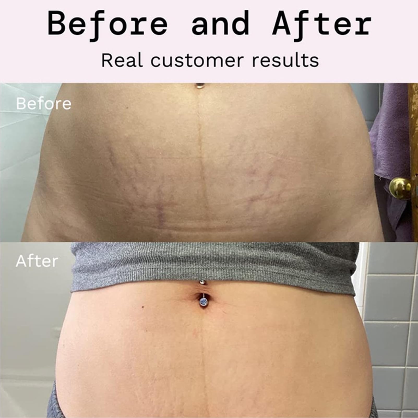 Rosarden Stretch Mark Prevention Cream for Pregnancy, Stretch Mark Cream Remover, Stretch Mark Lotion for Pregnancy, Tummy Butter for Stretch Marks Pregnancy, Shea Butter Stretch Mark Removal Cream