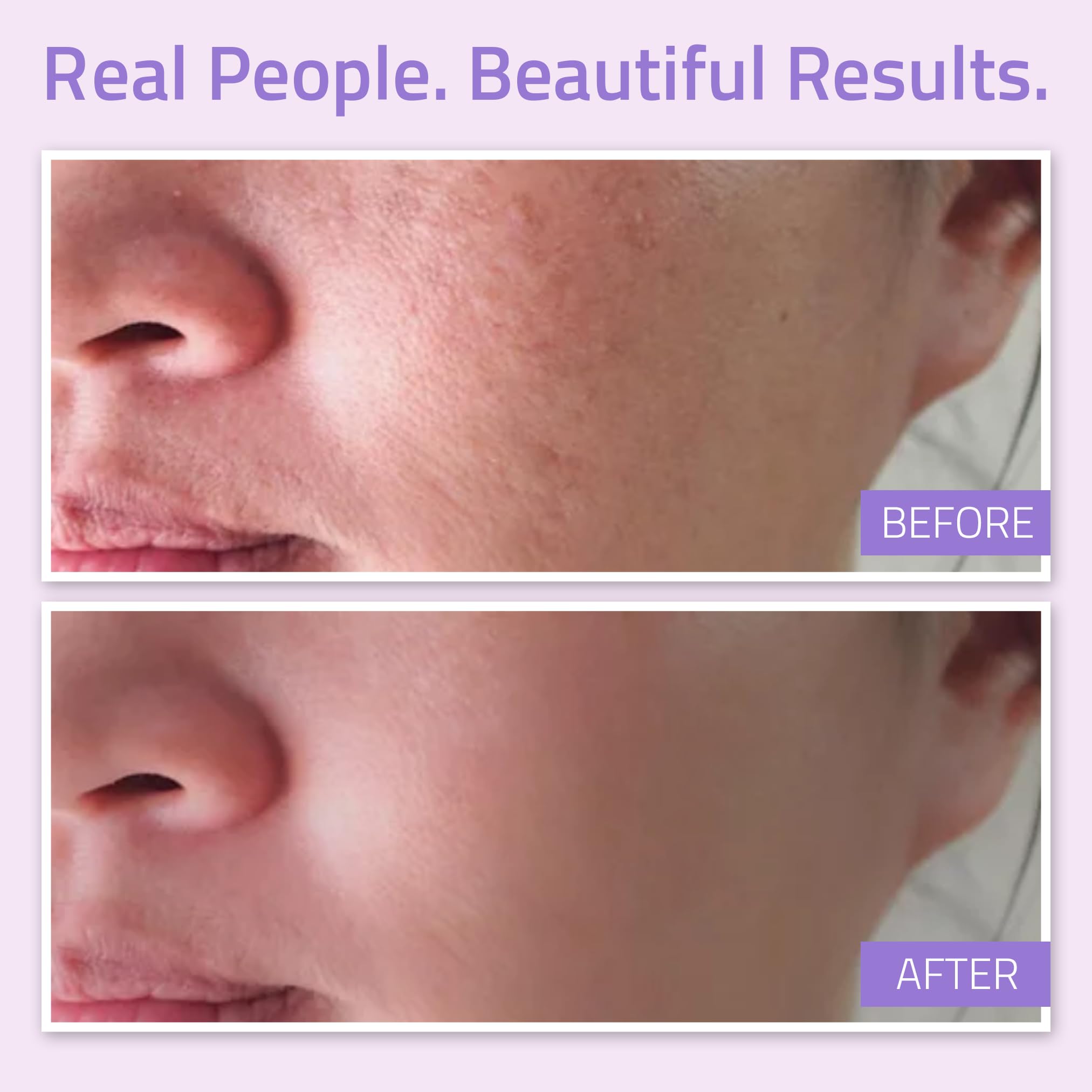 Best Balancing Facial Toner to Fight Aging Skin From YEOUTH, Hydrating Skin Toner For Face Contains Chamomile Flower, Allantoin, Alcloxa, The Most Advanced Anti Aging Toner Available, 100% GURANTEED