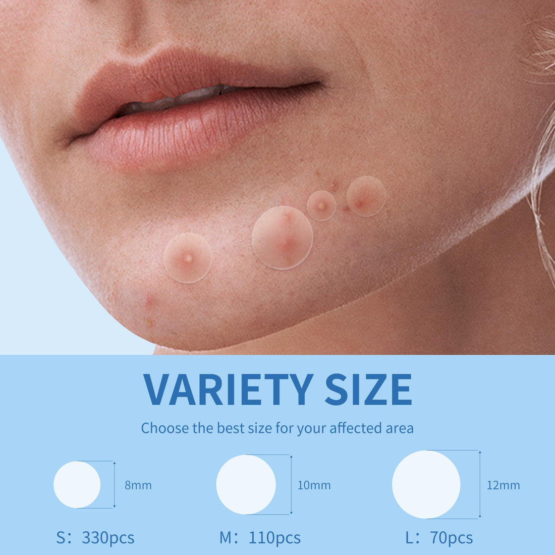 Daolyo Pimple Patches for Face, 3 Size 510 Counts Hydrocolloid Acne Patches for Covering Zits and Blemishes, Spot Stickers with Salicylic Acid, Tea Tree Oil & Calendula Oil(8mm,10mm,12mm)