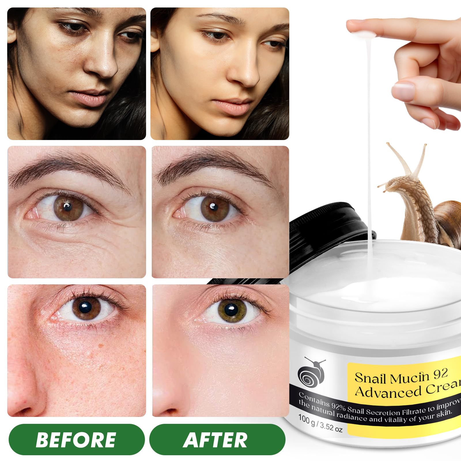 ITSDAWN Snail Mucin 92% Repair Cream 100g, Face Moisturizer Hydrating Repair Face Cream for Dry & Sensitive Skin, All Skin Types