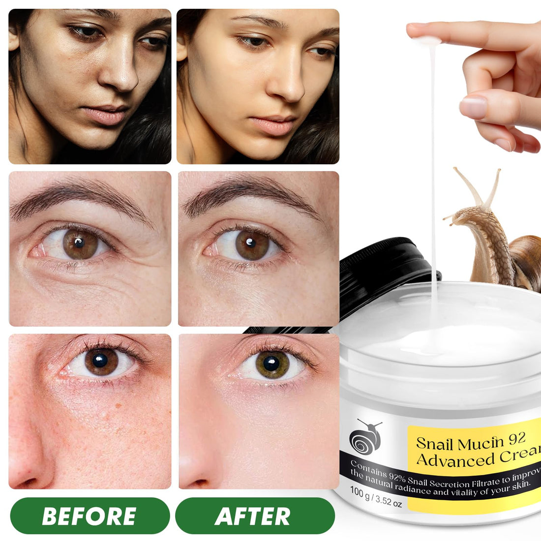 ITSDAWN Snail Mucin 92% Repair Cream 100g, Face Moisturizer Hydrating Repair Face Cream for Dry & Sensitive Skin, All Skin Types