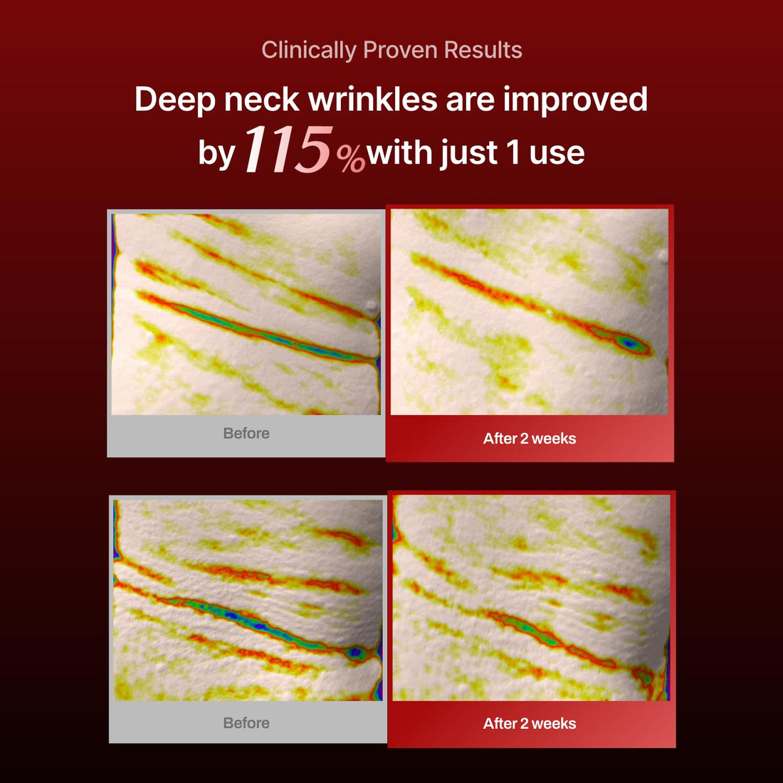 Wrinkle-fit Neck Mask - Neck Wrinkle Patches, Neck Firming and Tightening Korean Deep Collagen Mask - Hyaluronic Acid Neck-Targeted Mesh Sheet Mask for Lifting Sagging Skin - Boosting Elasticity 7EA
