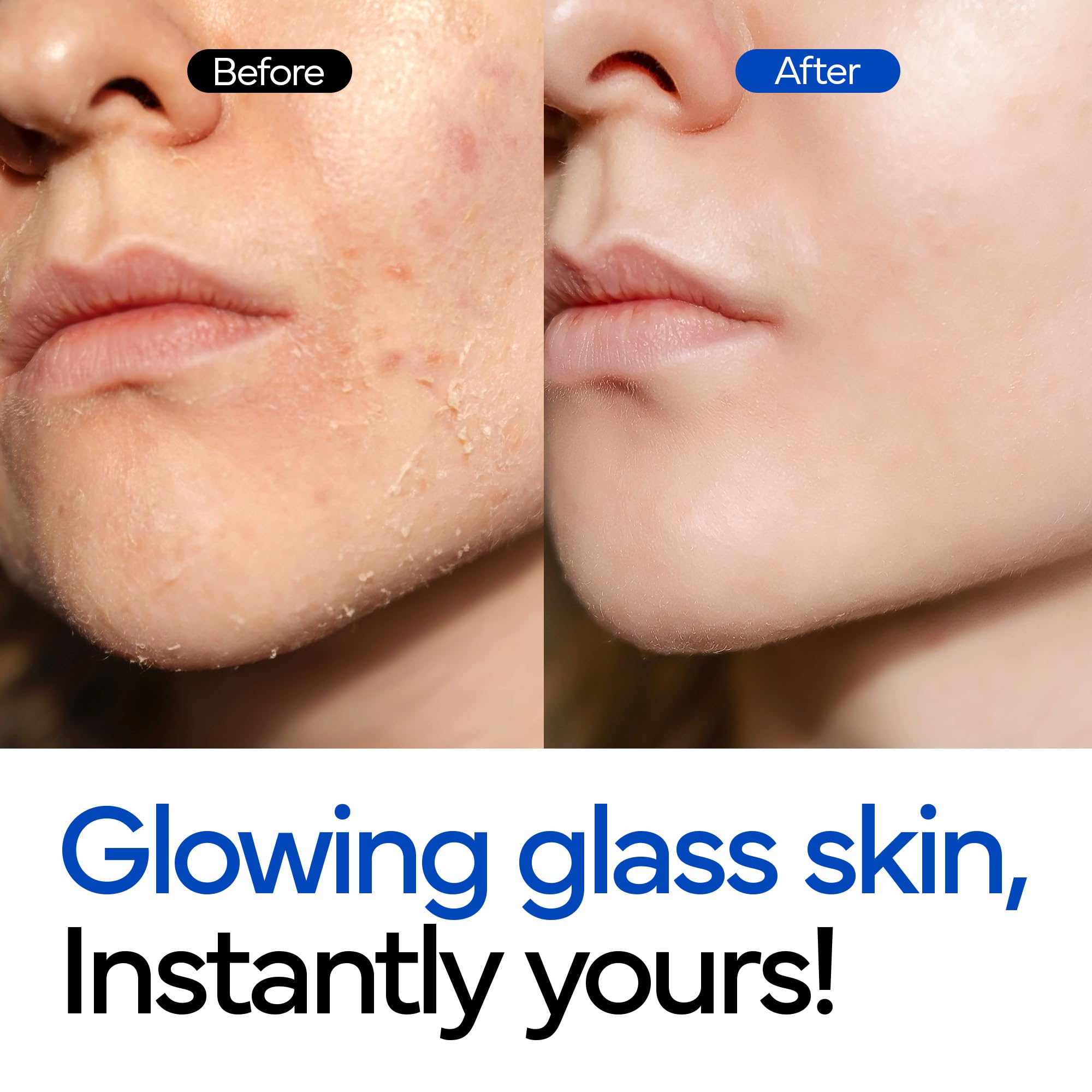 IVOSKIN Rice Milky Bubble Toner - Hydrating, Glowing Skin - Sensitive Skin - Niacinamide & Rice Extract (5.07fl.oz / 150ml)