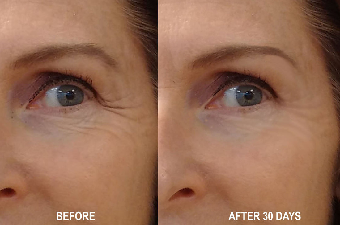Magic Night Serum-No Needle Alternative-Pure Argireline Peptides Overnight Firming Serum-Argireline, Matrixyl 3000, SNAP-8, Pentapeptide-18 (Leuphasyl), SYN-AKE, Copper Peptide,Syn-Coll, Syn-Tacks