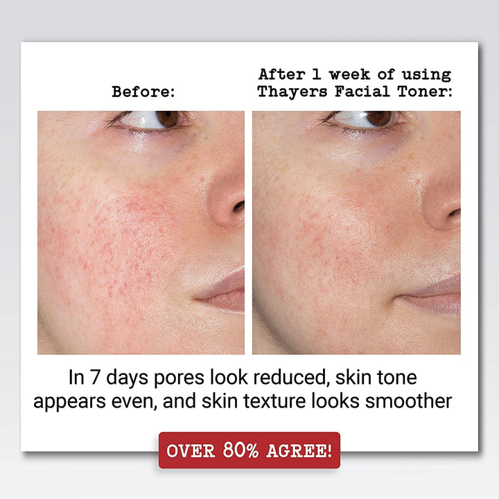 Thayer's: Witch Hazel with Aloe Vera, Rose Petal Toner 12 oz (2 pack)
