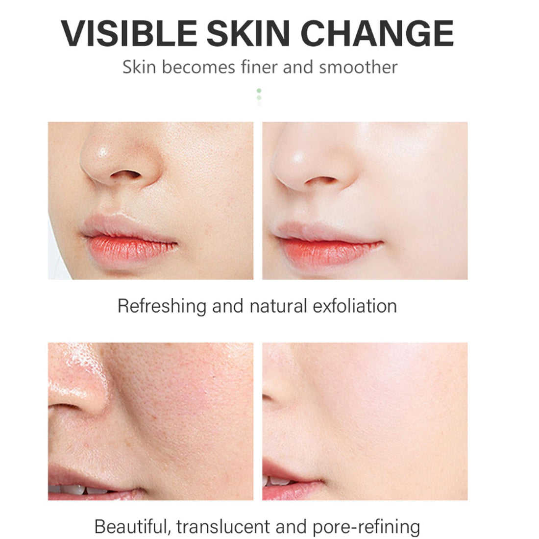 Salicylic Acid Solution (30 mL), Salicylic Acid 2% Solution, Gentle Exfoliating Serum for Smoother & Clearer Skin, Daily Use Facial Serum (1.05 fl oz)