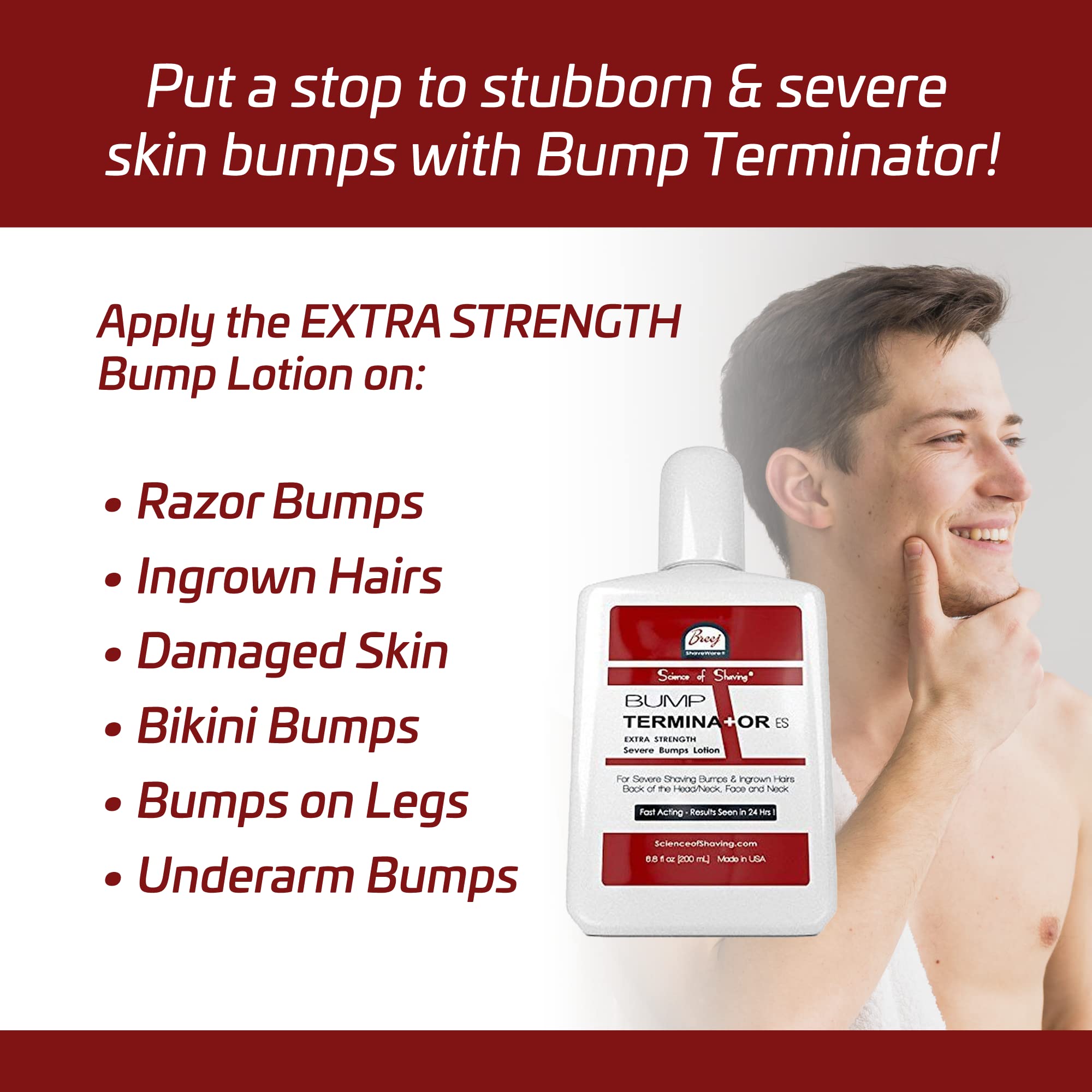 BUMP TERMINATOR Extra Strength Severe Bumps Lotion by Breej, 6.8 fl oz (2 ml)