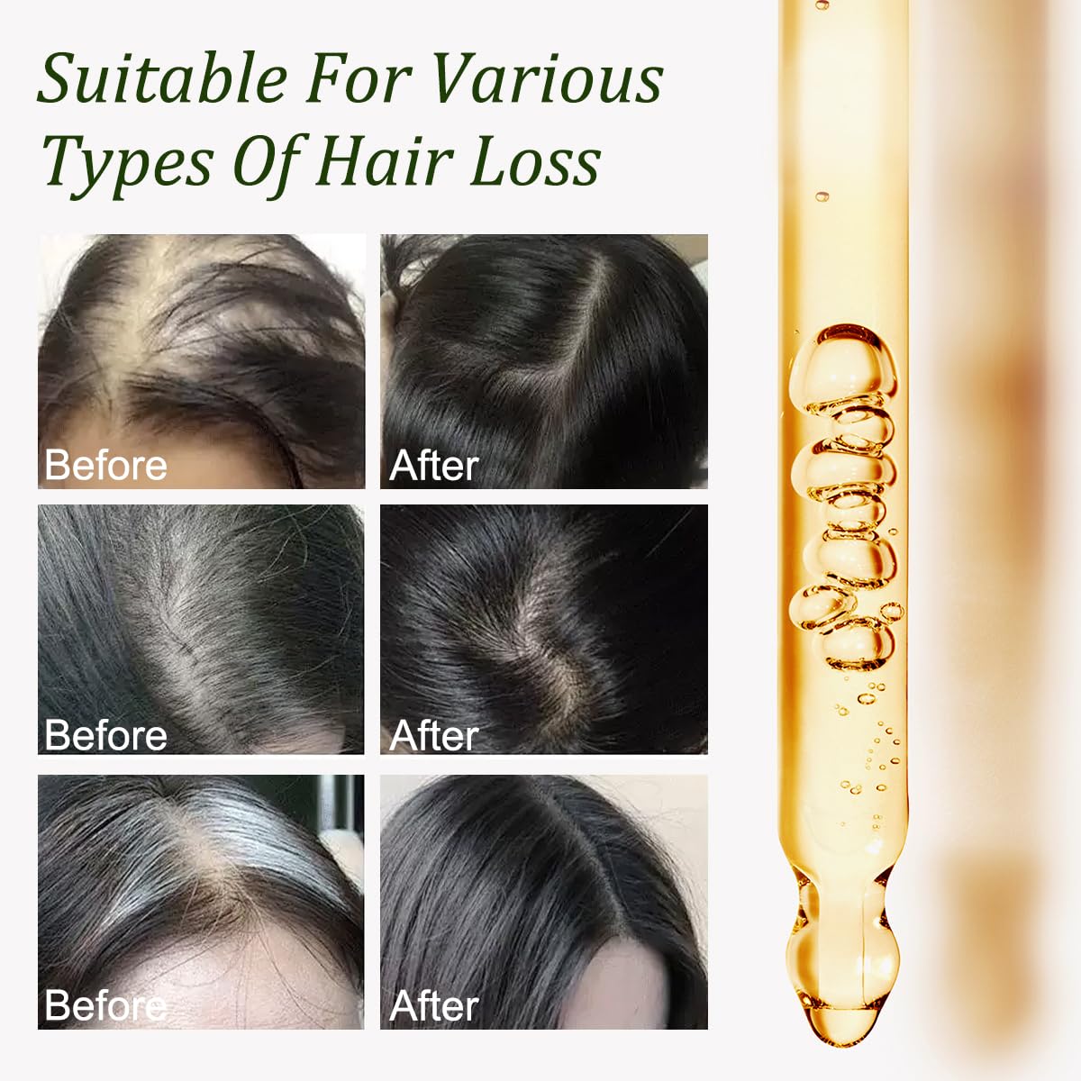 Batana Oil with Rosemary for Hair Growth -100% Pure Natural Hair Growth Oil,Nourishes The Scalp, Eliminates Split Ends, Reduce Hair Loss & Detox Your Scalp (1 Fl Oz) for All Hair Types