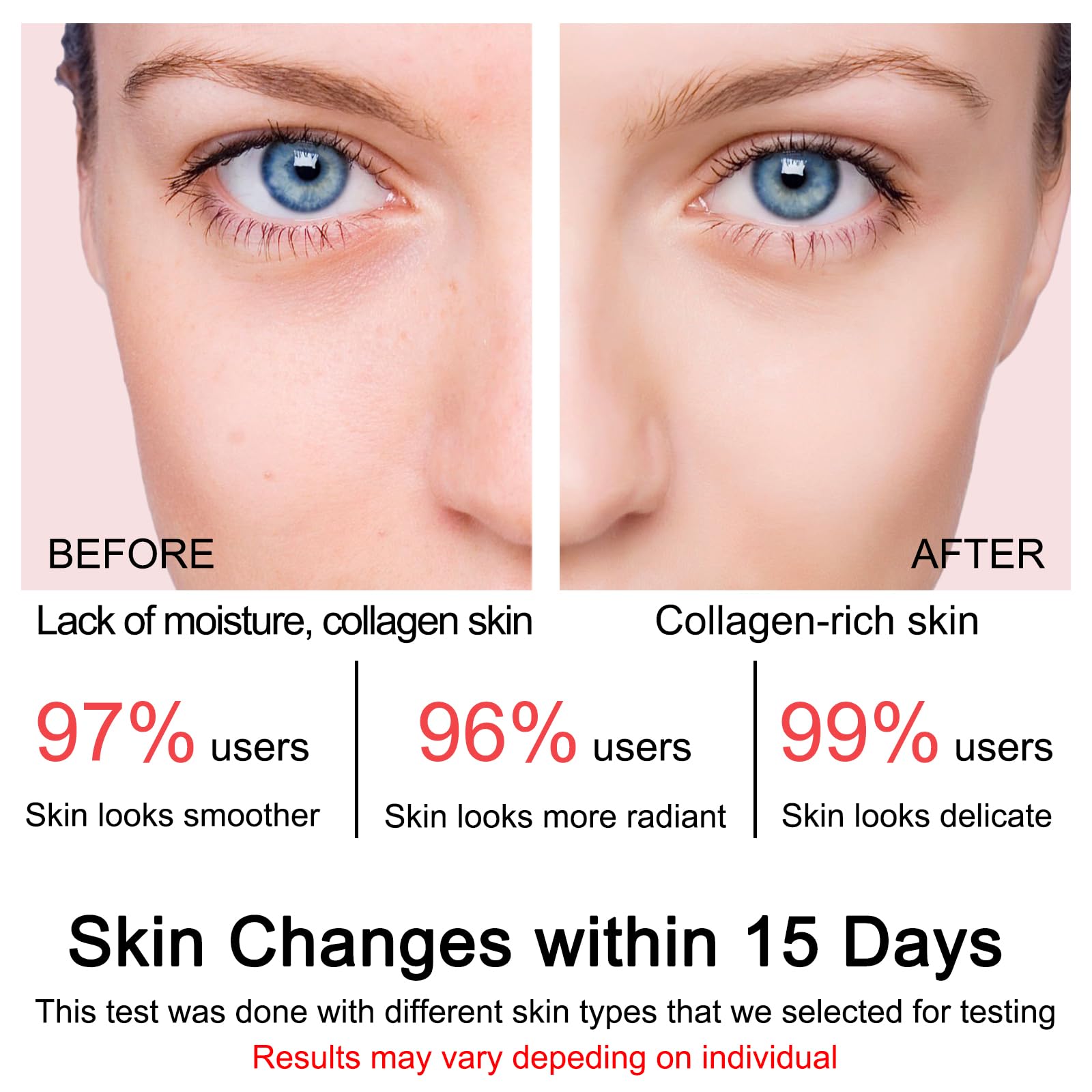 SOYUB Collagen Jelly Cream - Contains Niacinamide & Freeze Dried Hydrolyzed Collagen -Elasticity & Hydration, Reduce Fine Lines & Dullness, Korean Skin Care For All Skin Types (3.38 fl.oz)