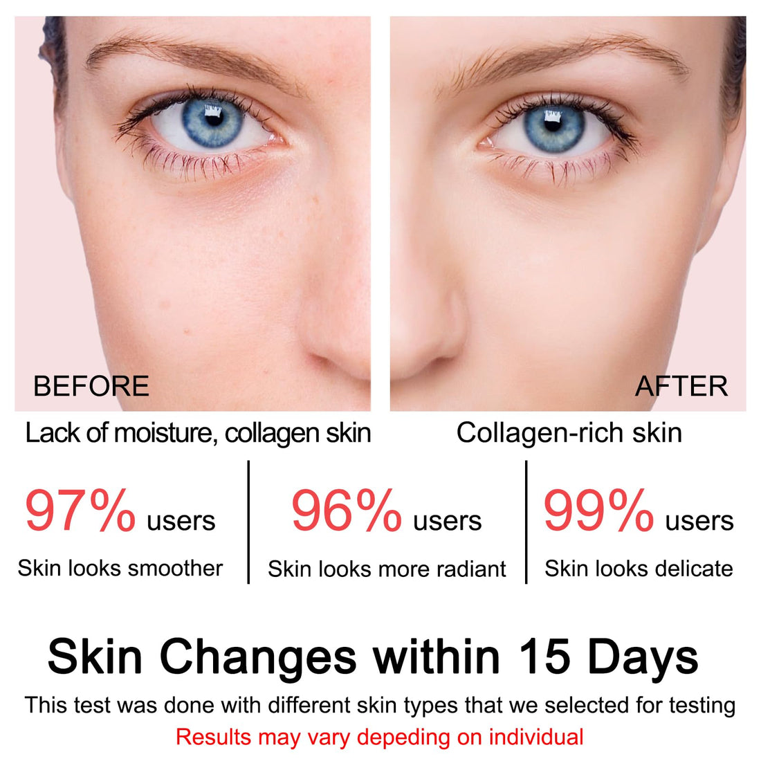 SOYUB Collagen Jelly Cream - Contains Niacinamide & Freeze Dried Hydrolyzed Collagen -Elasticity & Hydration, Reduce Fine Lines & Dullness, Korean Skin Care For All Skin Types (3.38 fl.oz)