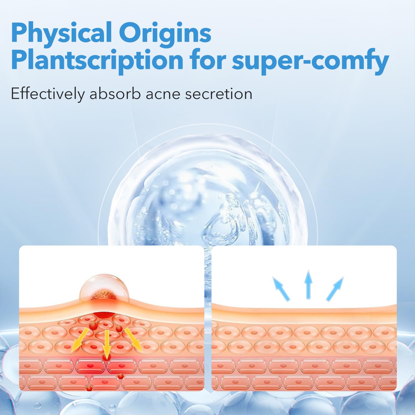 QUSTERE Pimple Patches for Face, Acne Patches Hydrocolloid, Cute Star Zit Covers for Face, Spot Stickers with Tea Tree, Salicylic Acid & Cica Oil| Round,Star,Peach Shapes| 5 Sizes| 282 Count