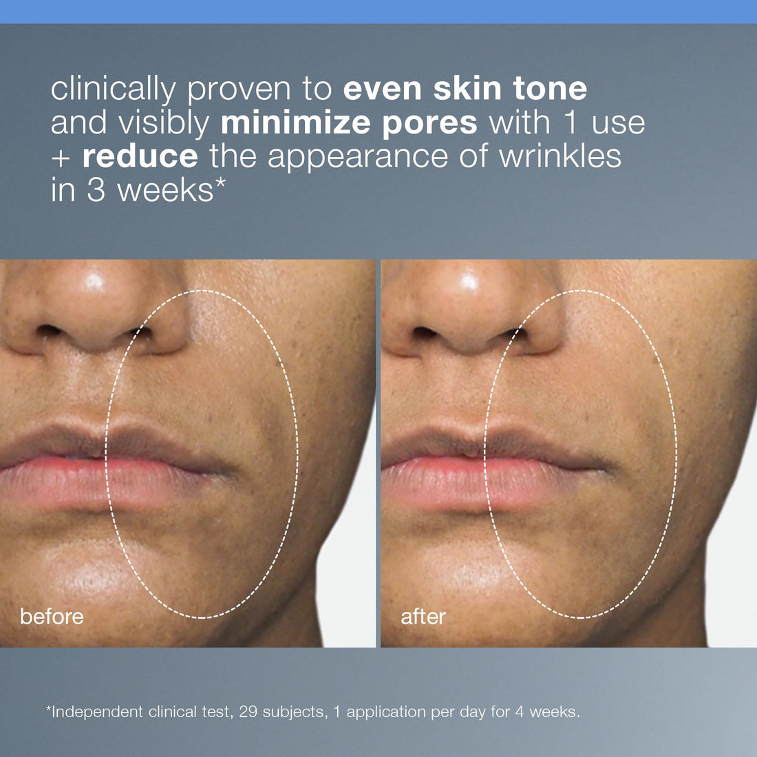 Dermalogica Liquid Peelfoliant with Glycolic Acid, Face Exfoliator Peel with AHA BHA PHA, Smooths Fine Lines and Wrinkles, Unclogs Pores, and Improve Skin Tone - 2 fl oz