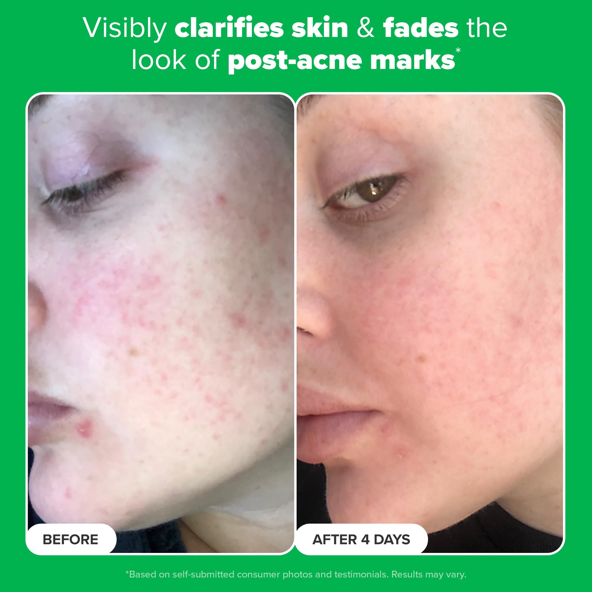 Paula's Choice BOOST 10% Azelaic Acid Booster Cream Gel, Licorice Extract & Salicylic Acid, Oil-Free Skin Brightening Serum, 1 Ounce