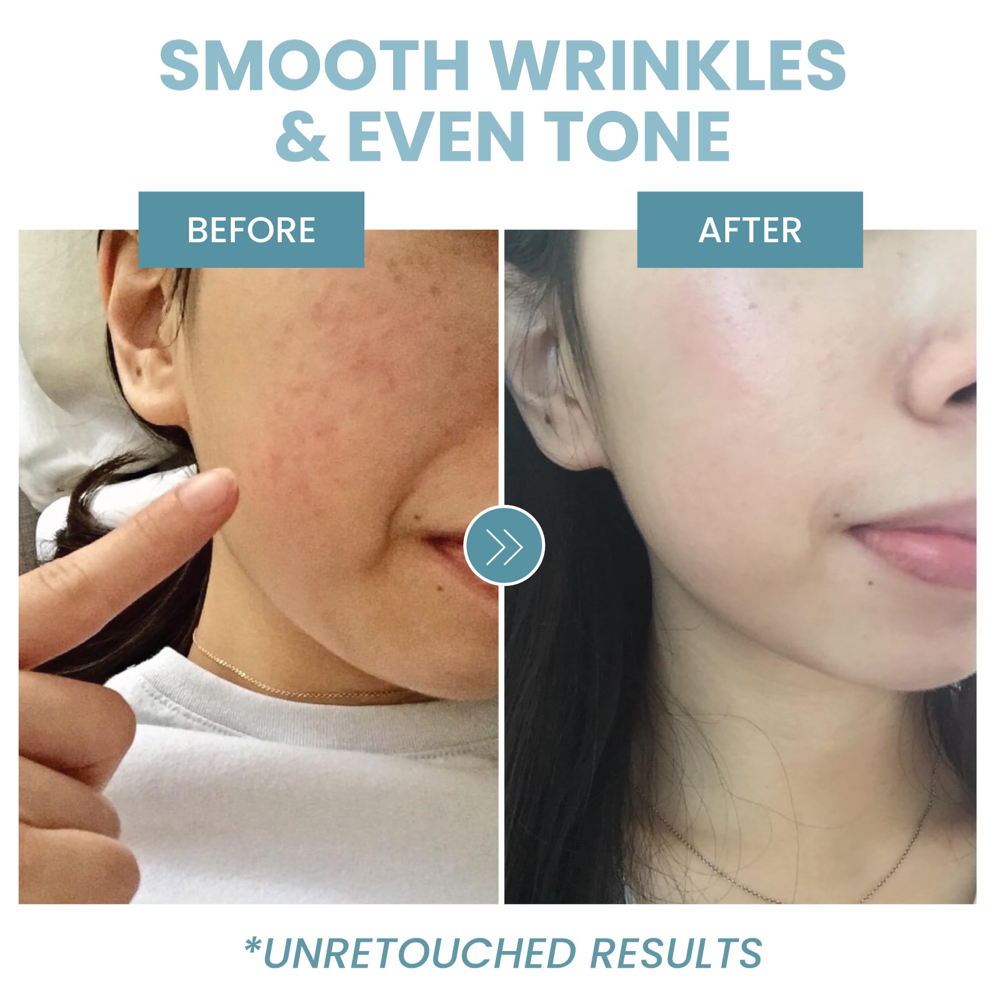 Eva Naturals Collagen Peptide Serum - Anti-Aging, Dark Spot Corrector, Skin Hydrator, Unisex, 2 oz