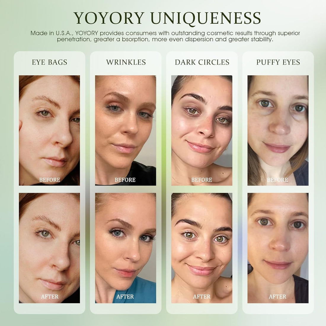 YOYORY Under Eye Patches - Eye Gel Masks for Wrinkles, Dark Circles, Puffy Eyes, Fine Lines, Eye Bags Treatment with Hyaluronic Acid Collagen, Moisturizing Hydrating 60 pcs,Green