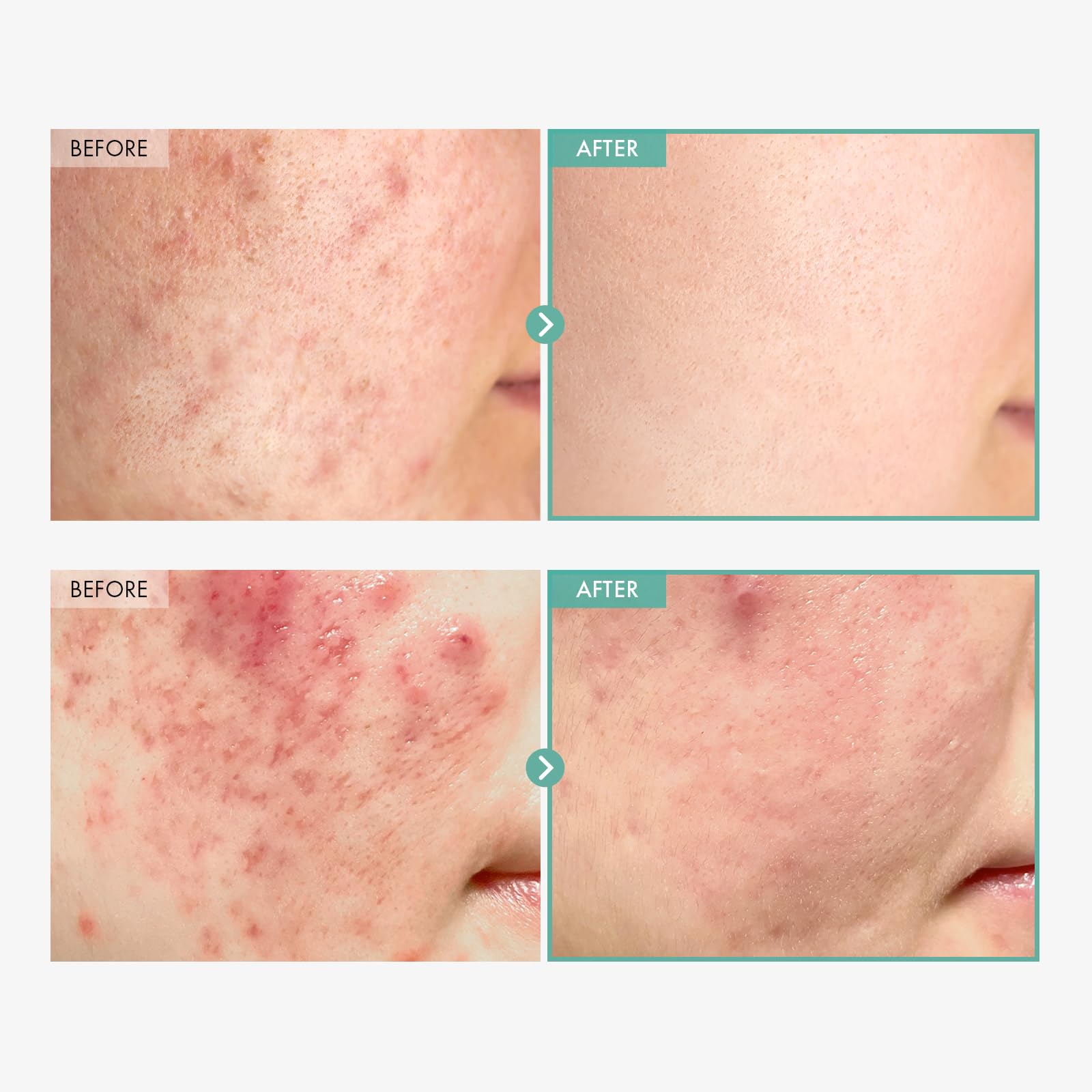 TOSOWOONG Dexpanthenol Cream, 170,000ppm B5 Panthenol, Madecassoside, Centella Asiatica for Skin Barrier Repair, Facial Moisturizer, Soothing, Hydrating, Korean Skincare, 60ml, 2.02 fl. oz.