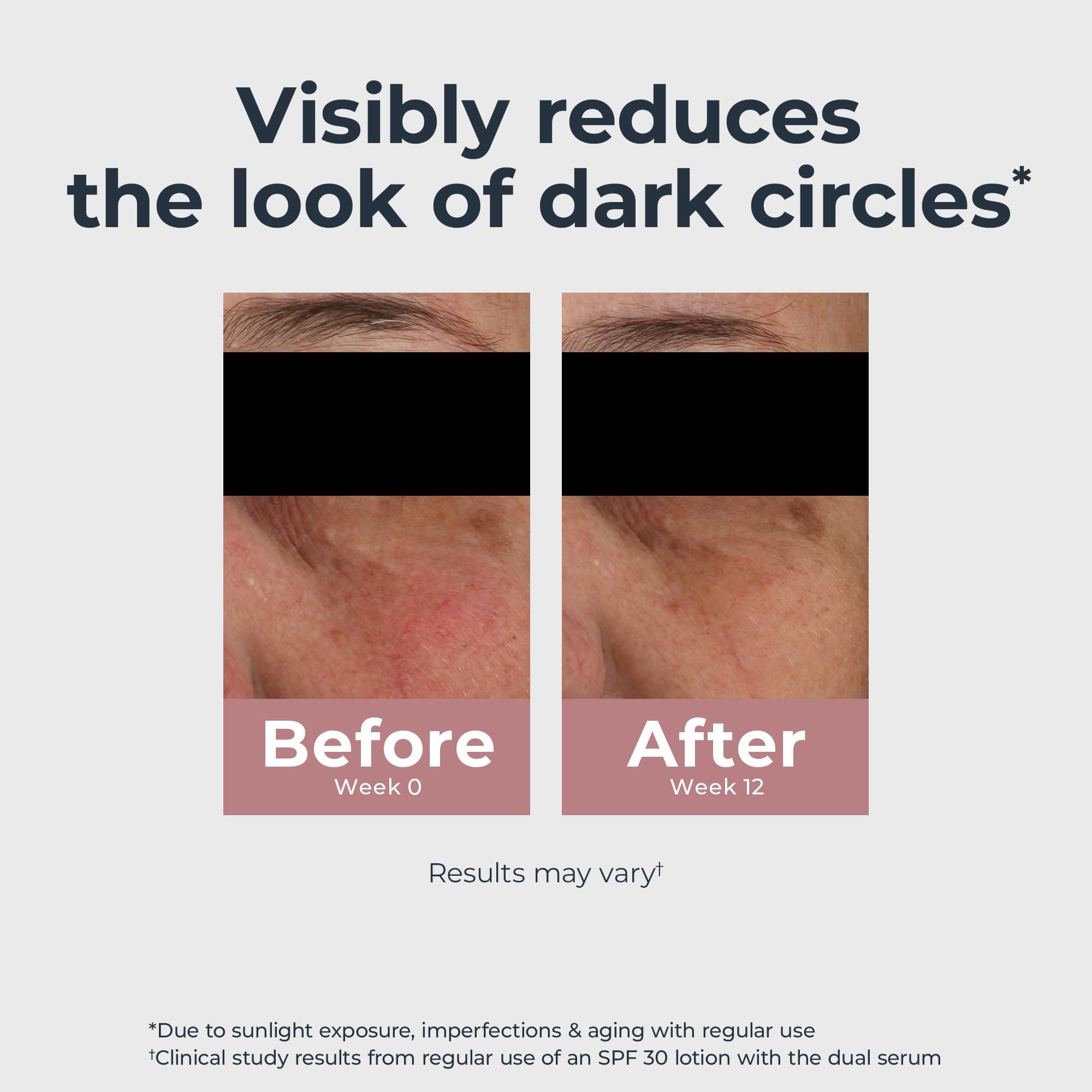 Eucerin Radiant Tone Eye Cream Dark Circle Corrector, Eye Brightening Cream with Thiamidol and Hyaluronic Acid, Helps Reduce the Look of Eye Puffiness, 0.5 Oz Tube