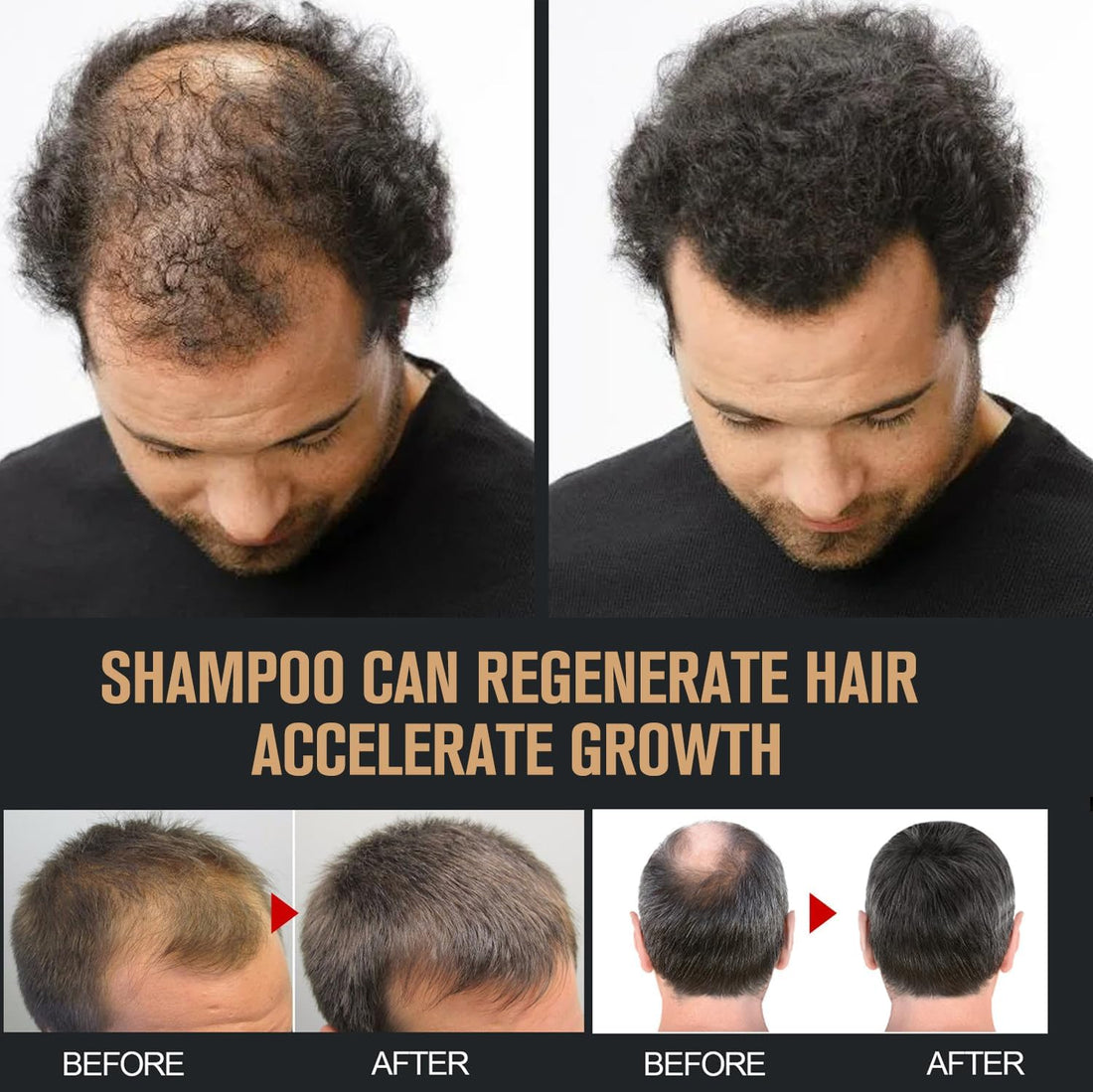 2 Pcs Root Activator Shampoo, Hair Growth Root Activator Shampoo, For Anti-Hair Loss, Natural Formula for Men and Women
