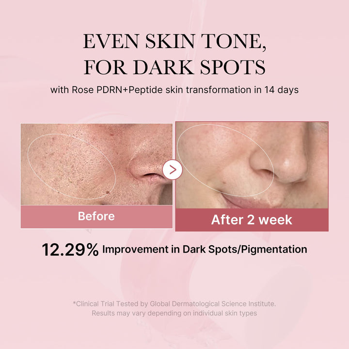 medicube PDRN Pink Peptide Toner I Pink Glow Toner for Skin Boosting, Soothing and Calming, Uneven Skin Tone, Rose PDRN & Peptide & Niacinamide, Korean Skin Care (250ml / 8.45 fl. oz.)