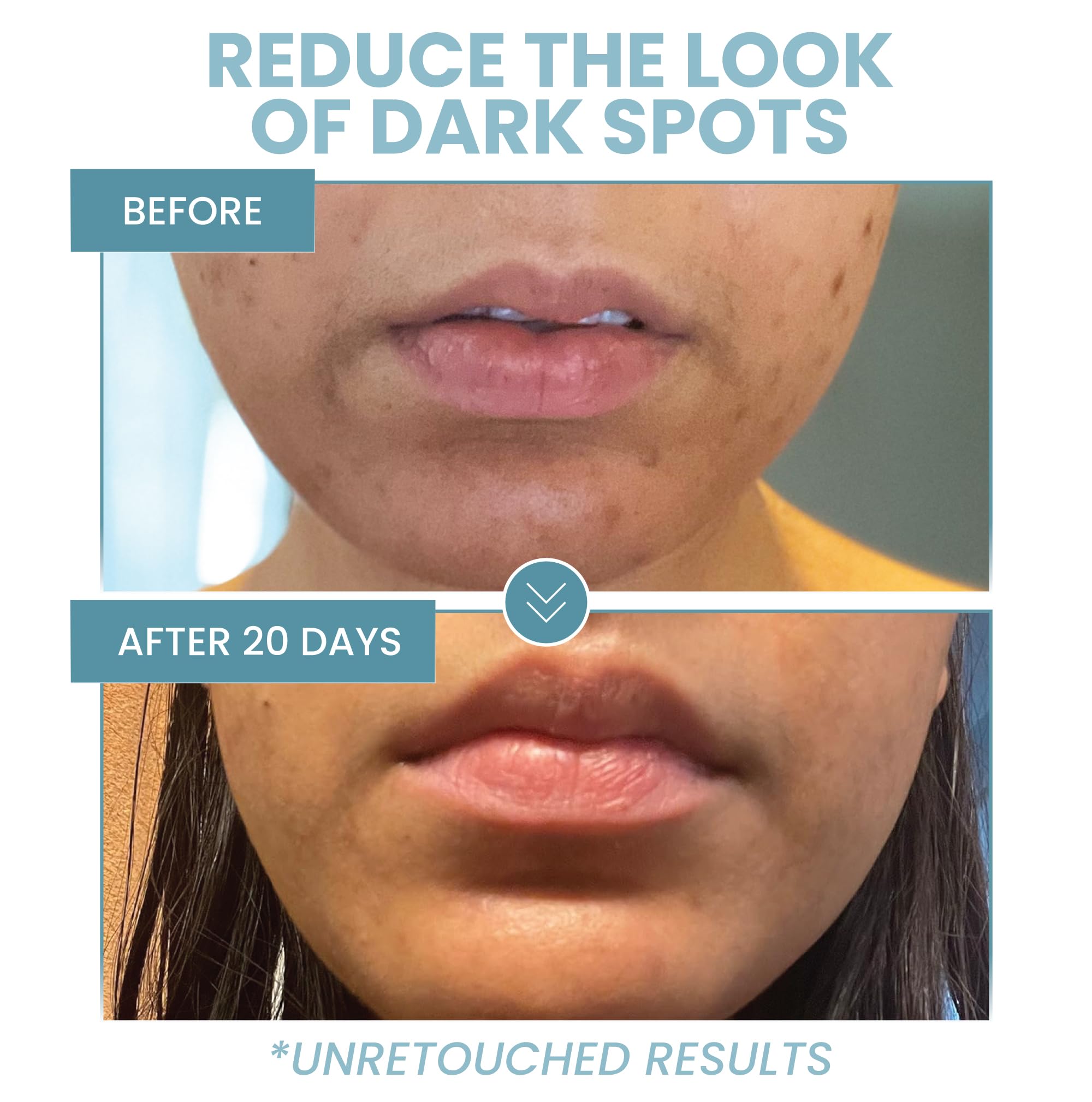 Niacinamide Serum for Face - 12% Niacinamide & 2% Zinc Serum with Hyaluronic Acid - Pore Minimizer, Improve Dark Spots, Redness Relief (2 oz)