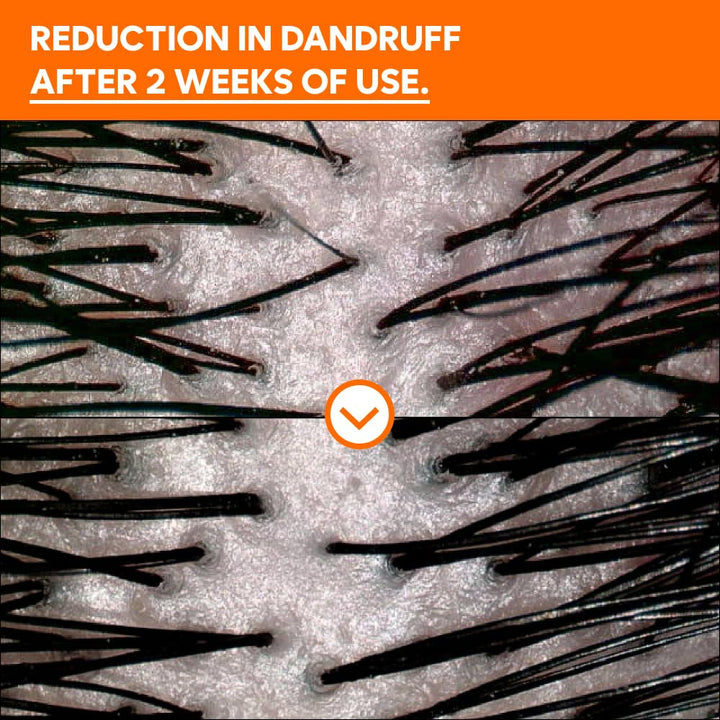 CHUNGMIJUNG Conditioning Kelp Shampoo – Scalp Care & Gentle Cleansing with Laminaria Japonica & Centella Asiatica – Korean Haircare for Sensitive Scalp & Dry Hair, 500ml / 16.9 fl.oz.