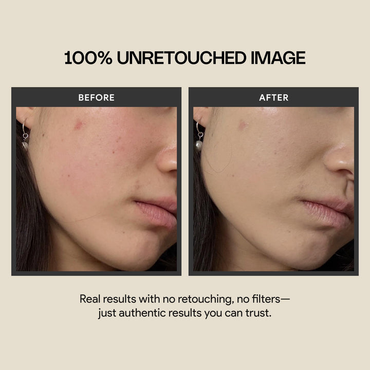 Meebak Cica Redness Solution Cream Lite | Redness Relief | Green Color-Corrector | CC Cream w/Niacinamide | Tinted Moisturizer - Fair to Medium Skin