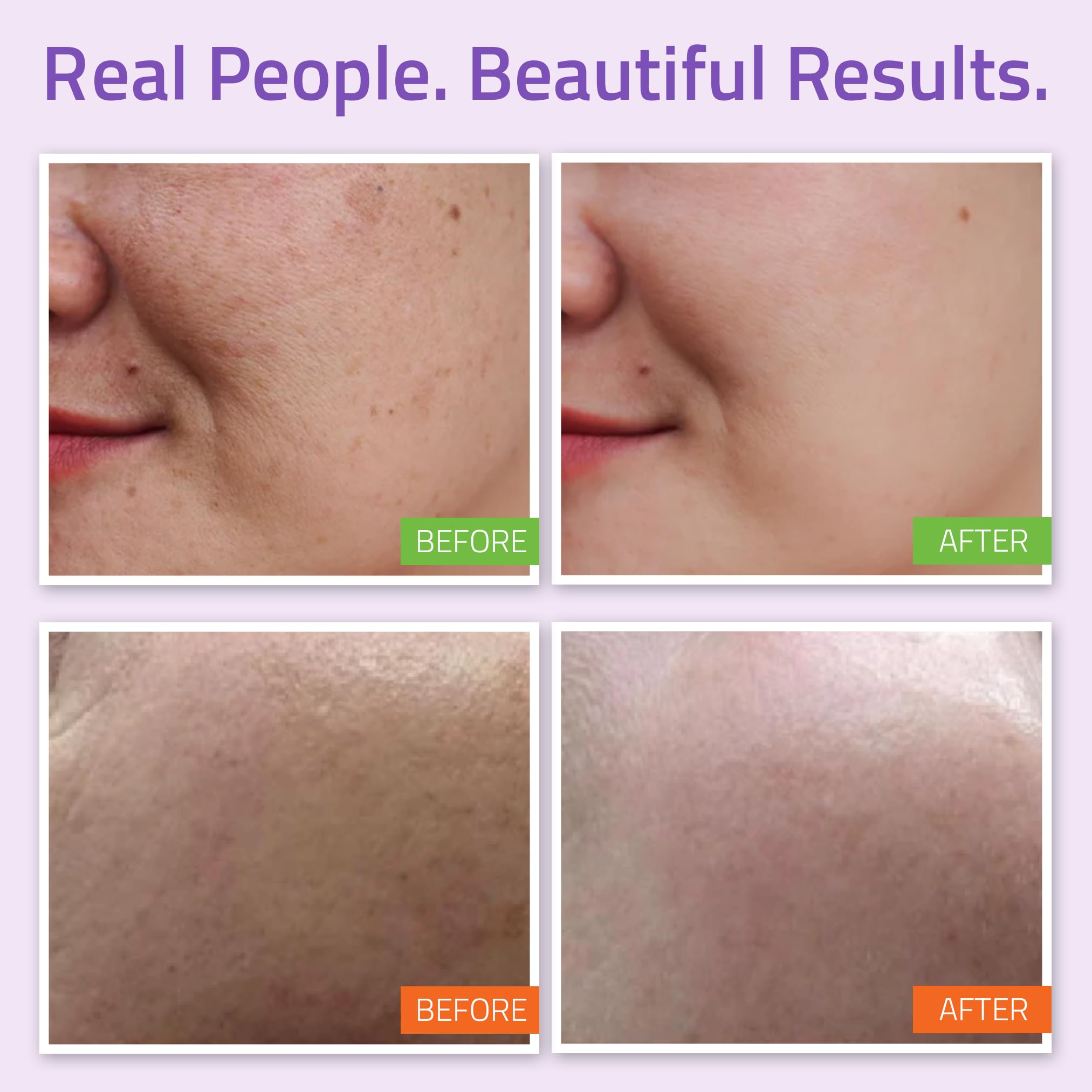 Best Complete Anti-Aging Skin Care System, YEOUTH Deluxe 5 Pack - Balancing Facial Toner*Vitamin C & E Serum*Hyaluronic Acid Plus*Radiance Eye Gel*L22 Patented Moisturizer-100% Money Back Guarantee