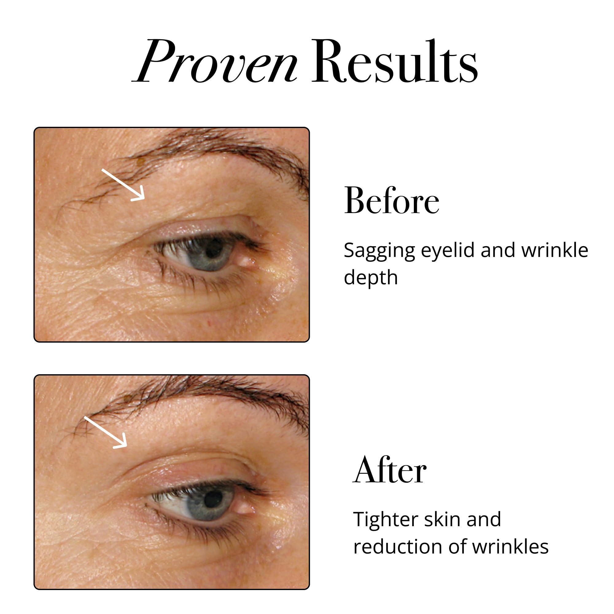 Glotrition Collagen Boost | Skin, Hair, Nails & Joint Support | Reduce Wrinkles and Firm Skin | All-Natural, Non-GMO Collagen for Women & Men 15ct