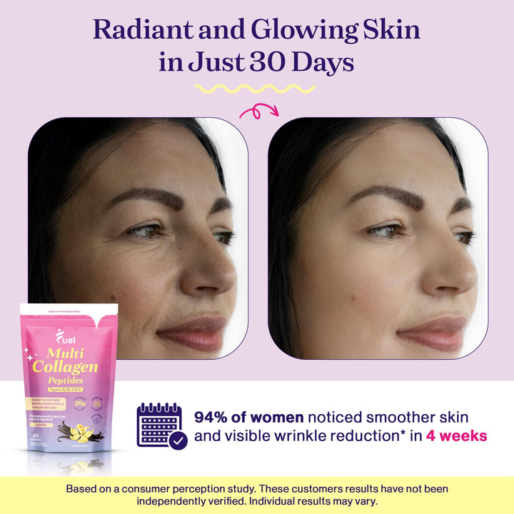 Fuel Multi Collagen Protein Powder - Resveratrol Extract, Multi Collagen Peptides - Hydrolyzed Collagen for Women with Hyaluronic Acid & Biotin Collagen Powder Promote Skin, Hair & Nail French Vanila