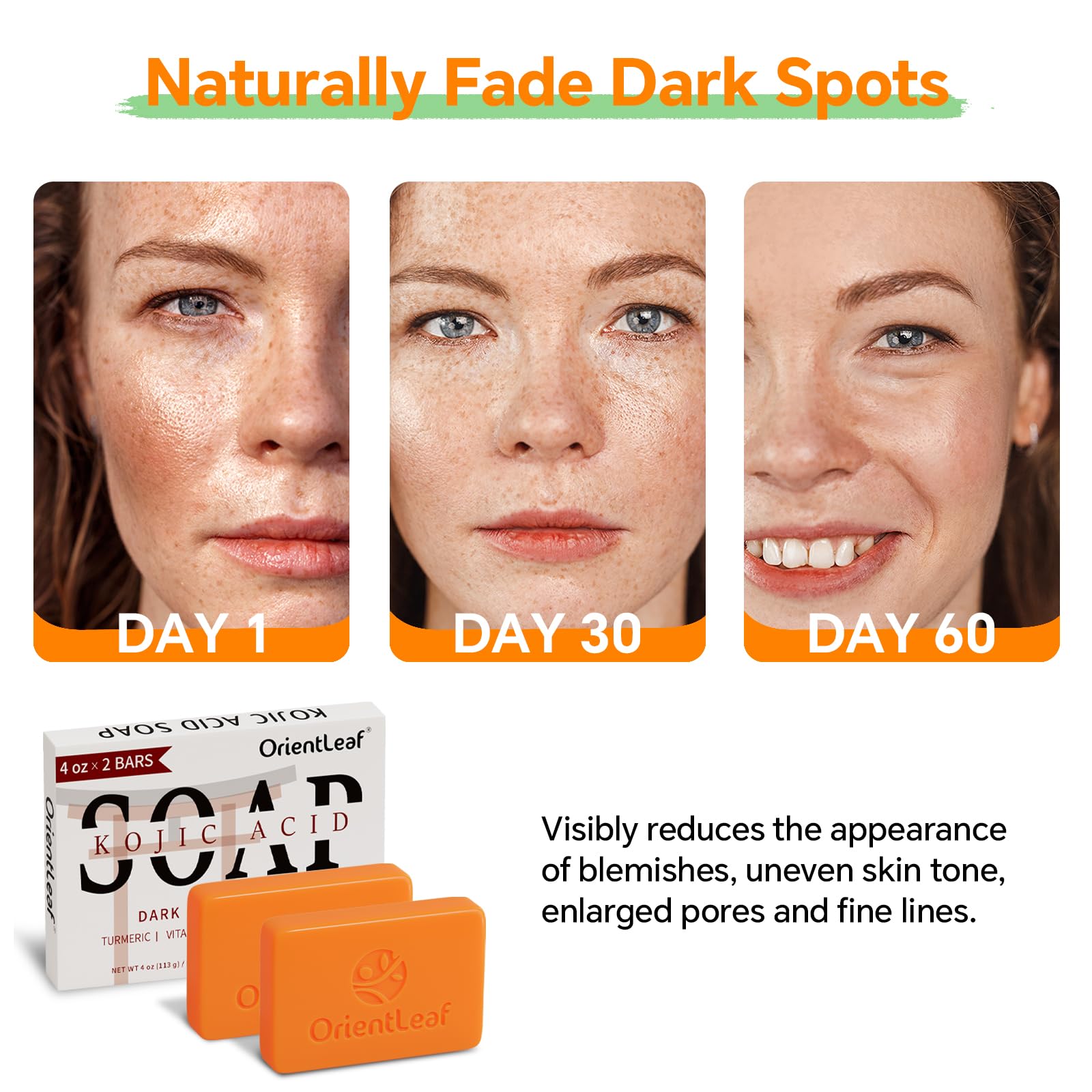 ORIENTLEAF Kojic Acid and Turmeric Soap for Dark Spots Remover, Brightening, Hyperpigmentation for Face, 4oz x 2 BARS
