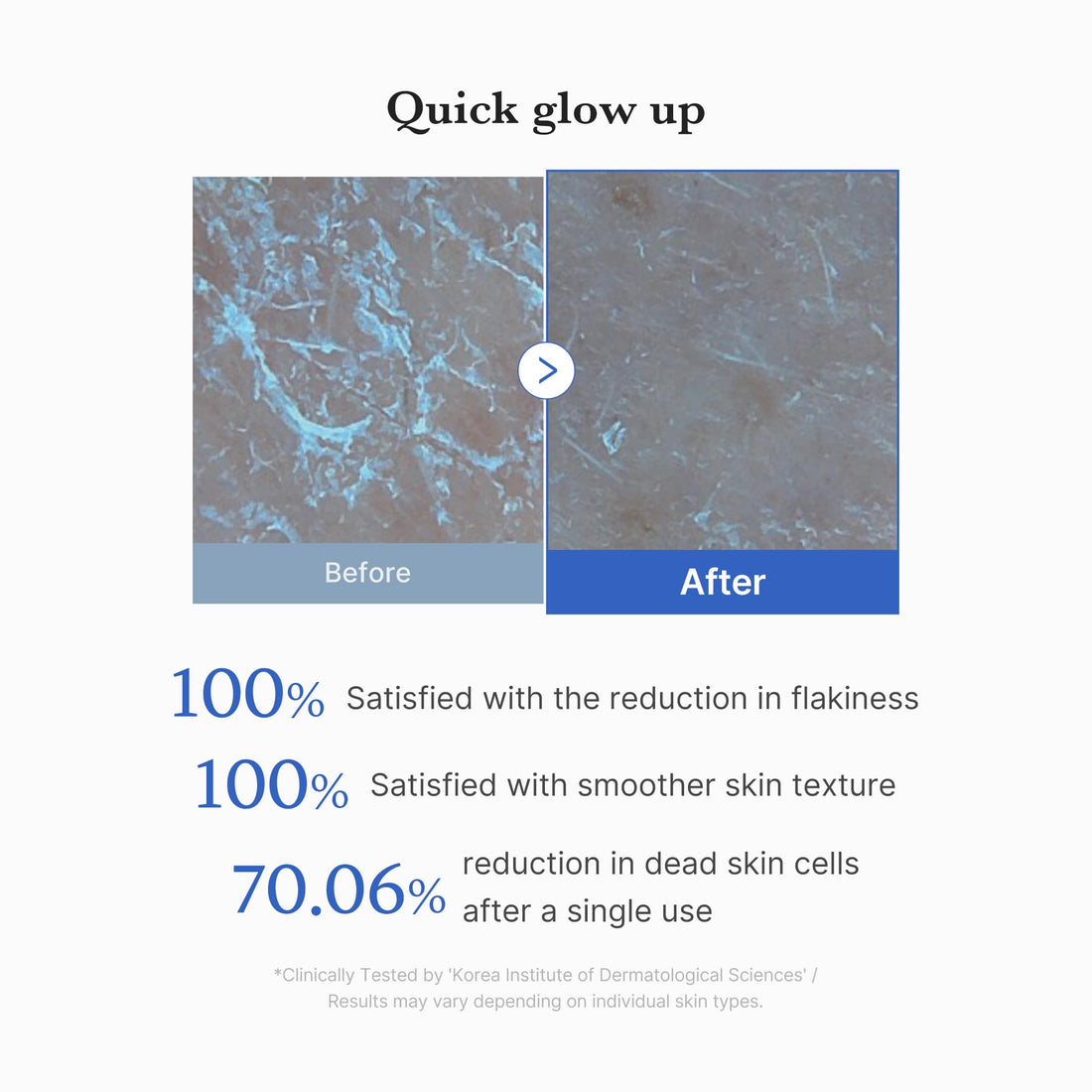 Zero Pore Peel Pads (8ea) | Smoothing Mitt for Face & Body | Rice Extract, Natural AHA & Panthenol | Double-Sided Organic Cotton & Microfiber Pads | Polish for Smooth, Clear Skin | Korean Skin Care