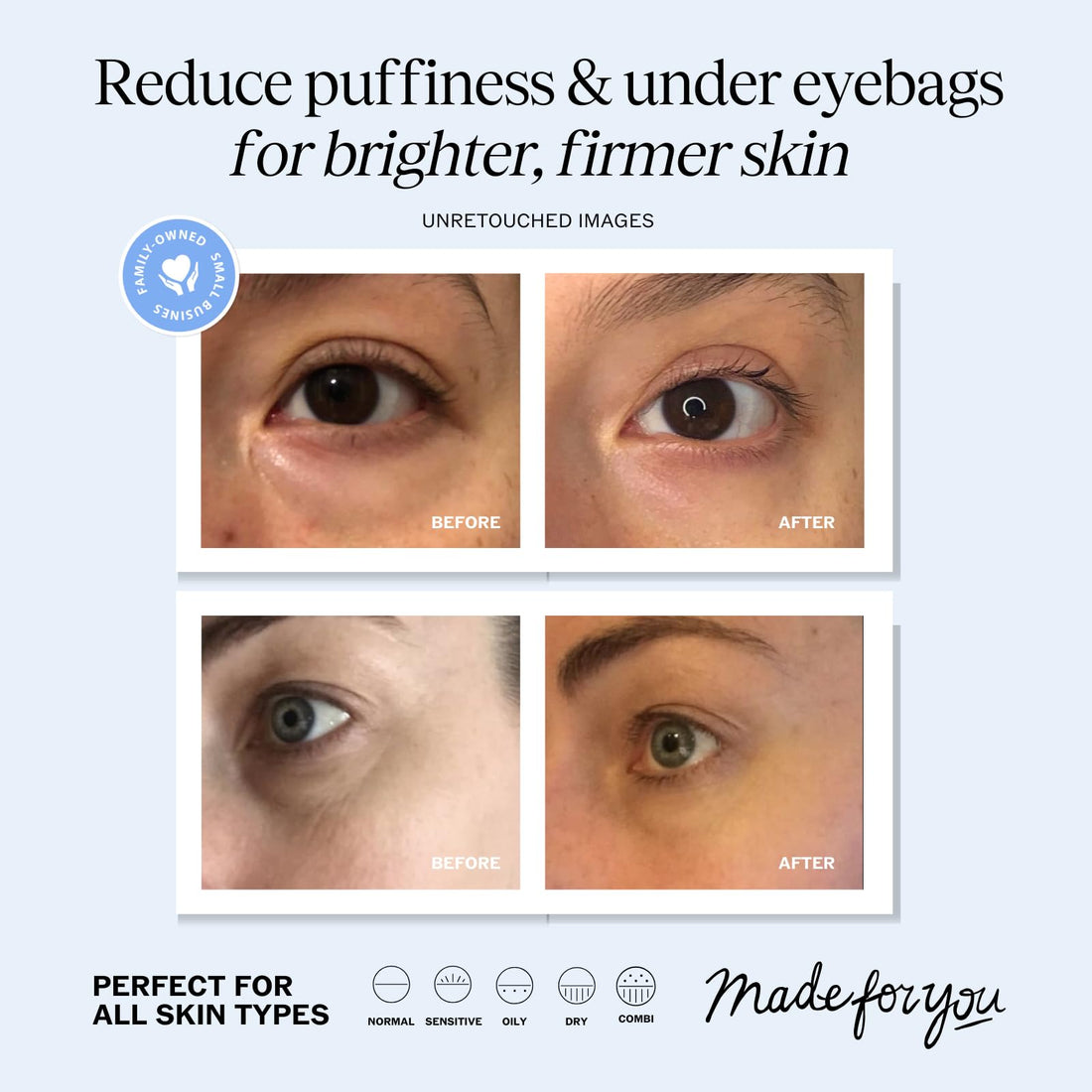 LilyAna Naturals Eye Cream for Dark Circles and Puffiness, Under Eye Cream for Wrinkles and Bags, Anti Aging Cream helps Improve Dryness; for Sensitive Skin (Bottle, 0.5 Ounce (Pack of 1))