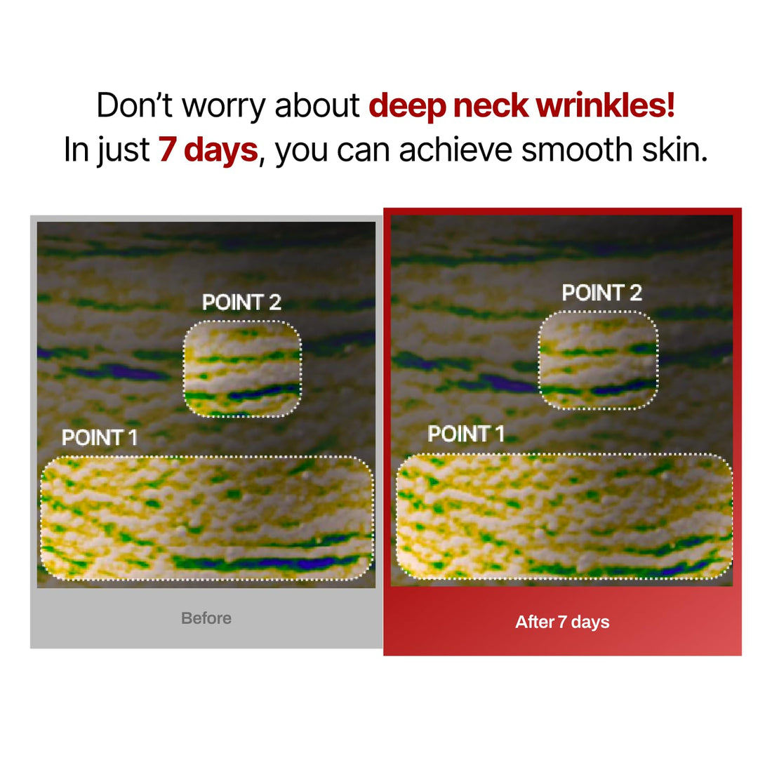 Wrinkle-fit Neck Mask - Neck Wrinkle Patches, Neck Firming and Tightening Korean Deep Collagen Mask - Hyaluronic Acid Neck-Targeted Mesh Sheet Mask for Lifting Sagging Skin - Boosting Elasticity 7EA