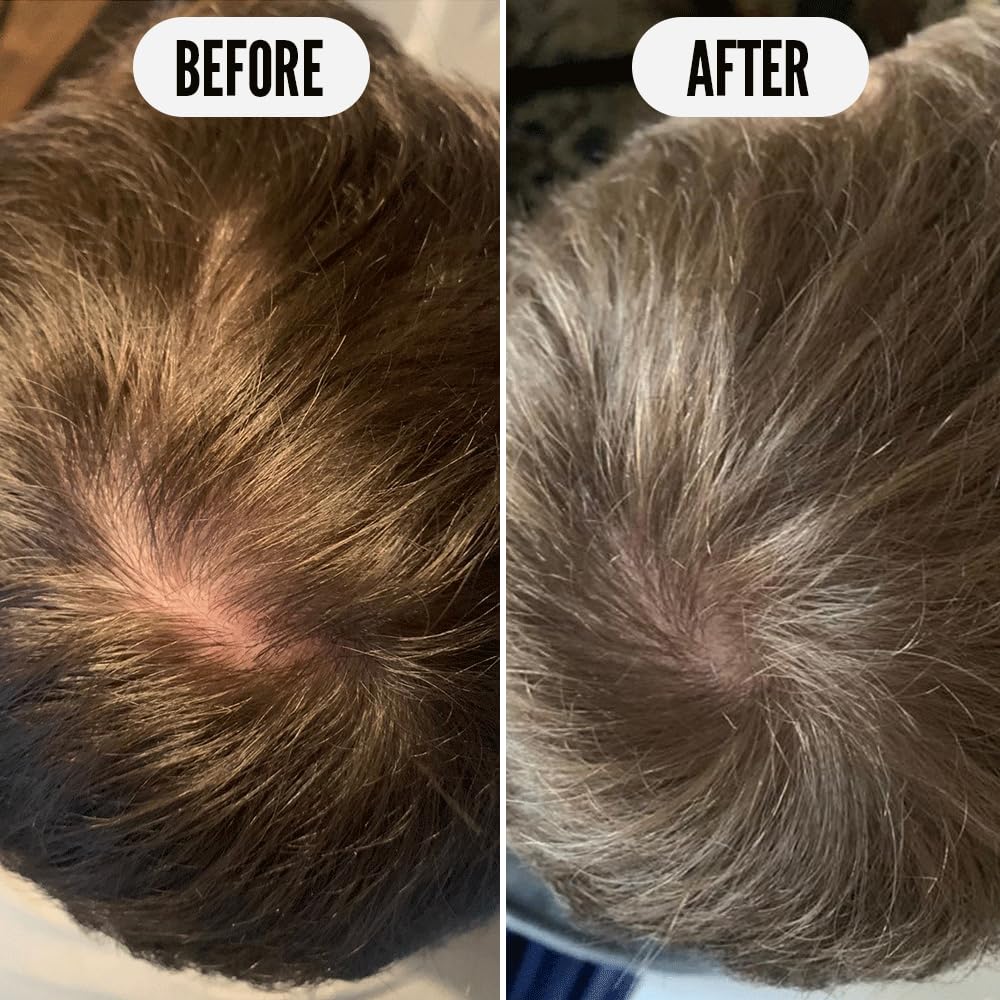 Noughty Get Set, Grow Hair Growth Conditioner Vegan Thickening Regrowth Repair Volumizing Hair, 250 ml, 8.4oz