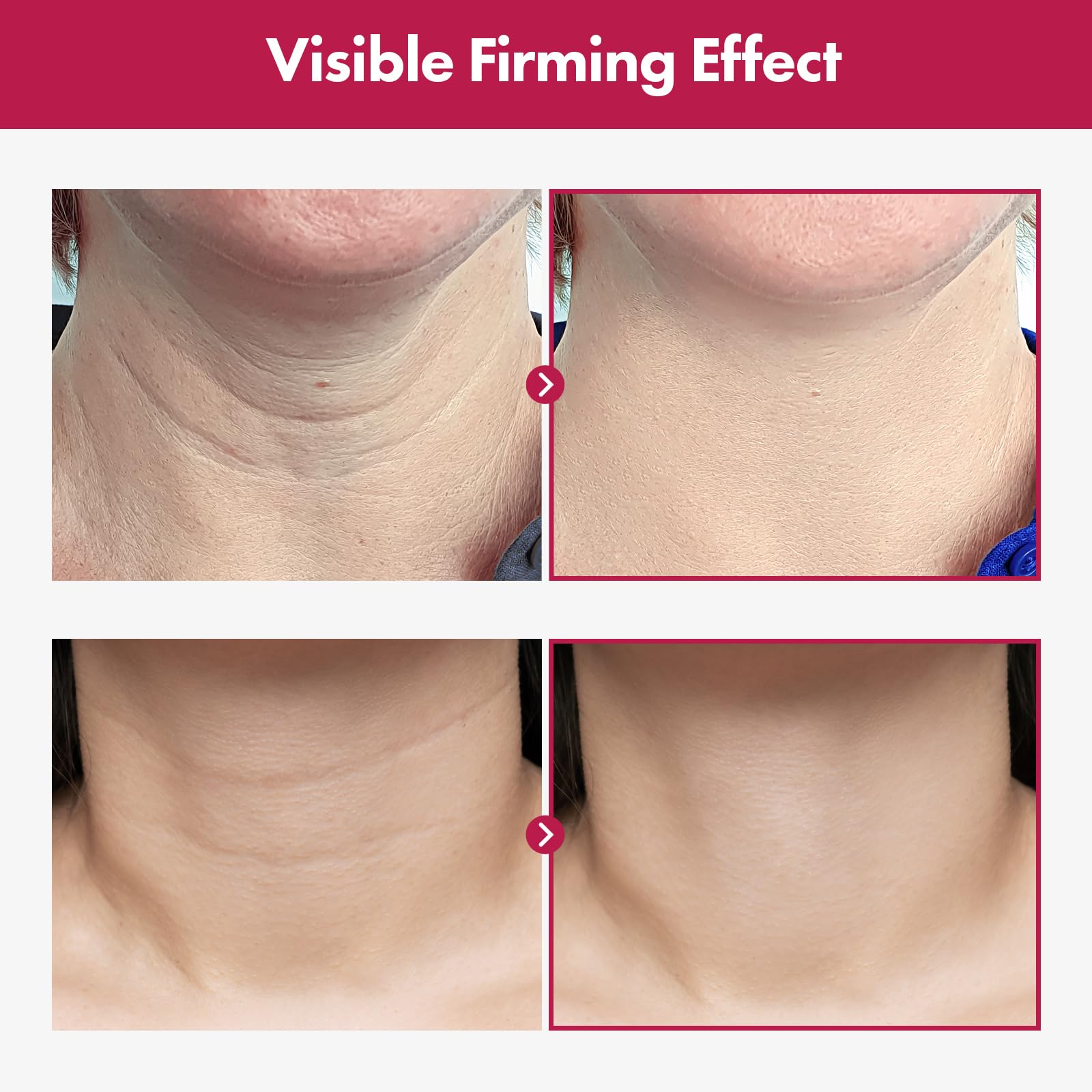 TOSOWOONG Collagen Necktox Cream with Collagen and Hyaluronic Acid for Neck Firming, Anti-aging, Wrinkles and Tightening, Korean Skin Care, 50ml, 1.69 fl. oz.