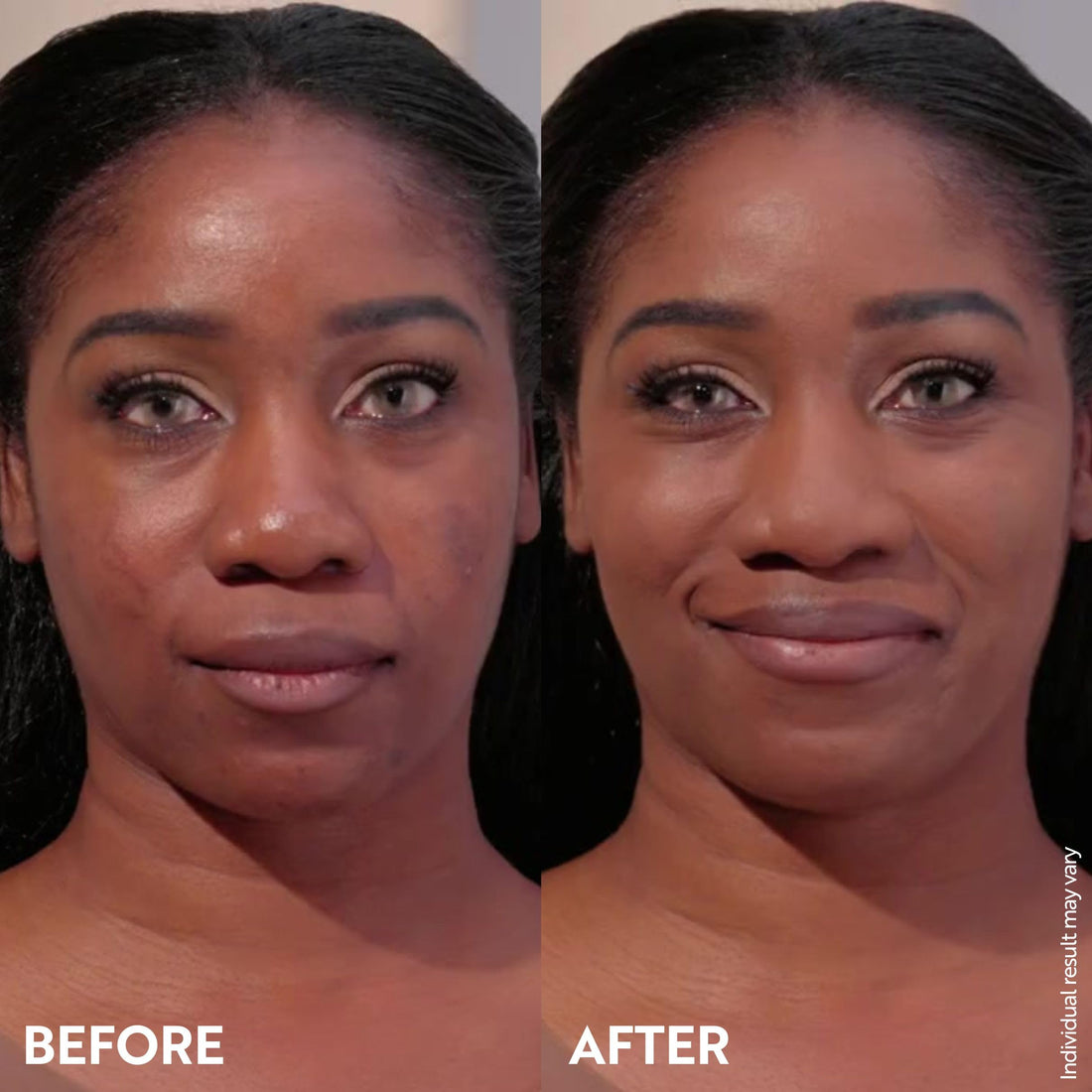 M. Asam Magic Finish Deep Teint Make-Up Mousse (1.01 Fl Oz) – 4in1 Primer, Foundation, Concealer & Powder With Buildable Coverage, Hides Redness And Dark Spots, Vegan, For Deeper Skin Tones