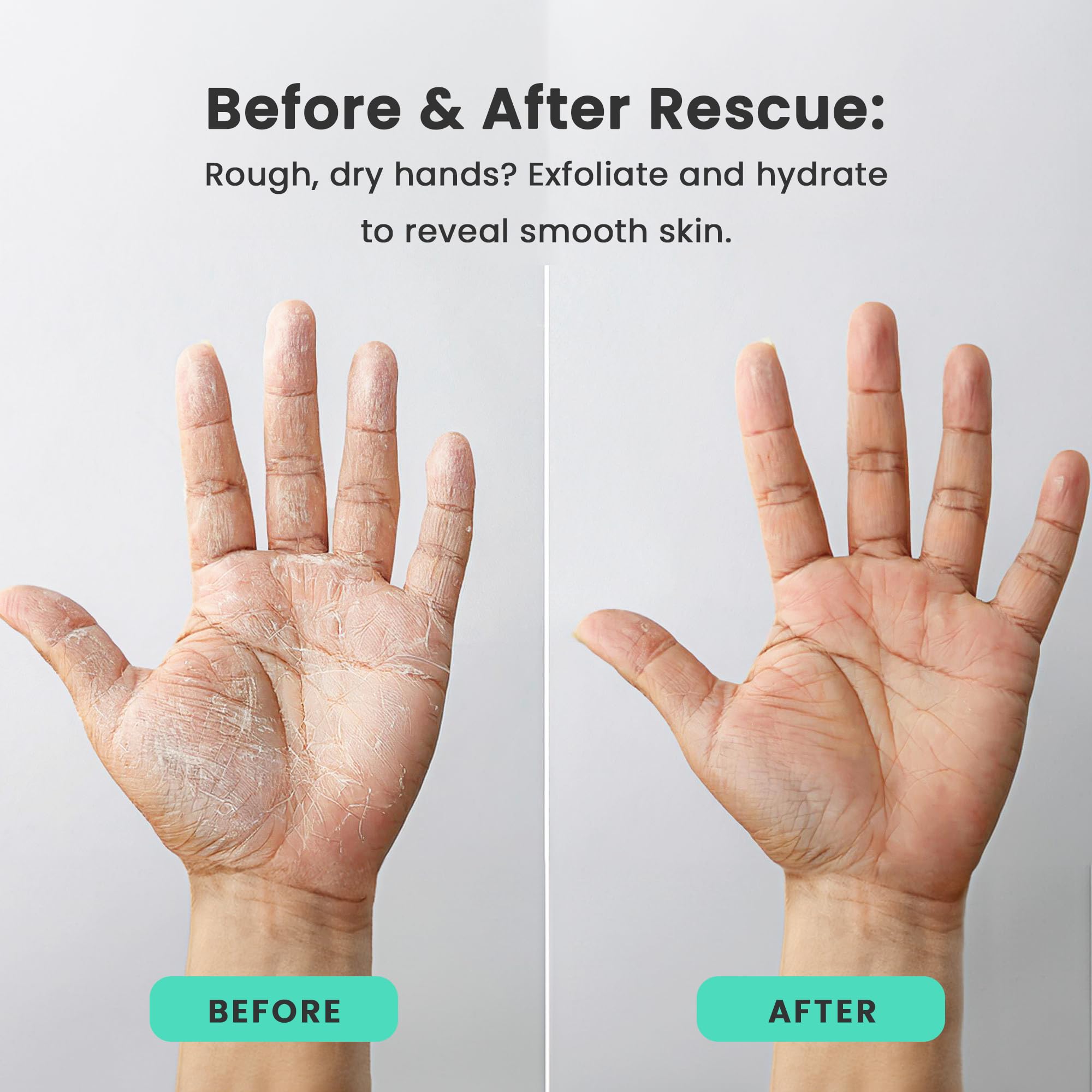 Dermasuri Day and Night Therapeutic Hand Cream for Dry, Cracked Hands - AM Lightweight Moisturizing Exfoliator & PM Overnight Renewal Lotion Softening Hydrating Treatment Unscented 3 oz Each Pack of 2