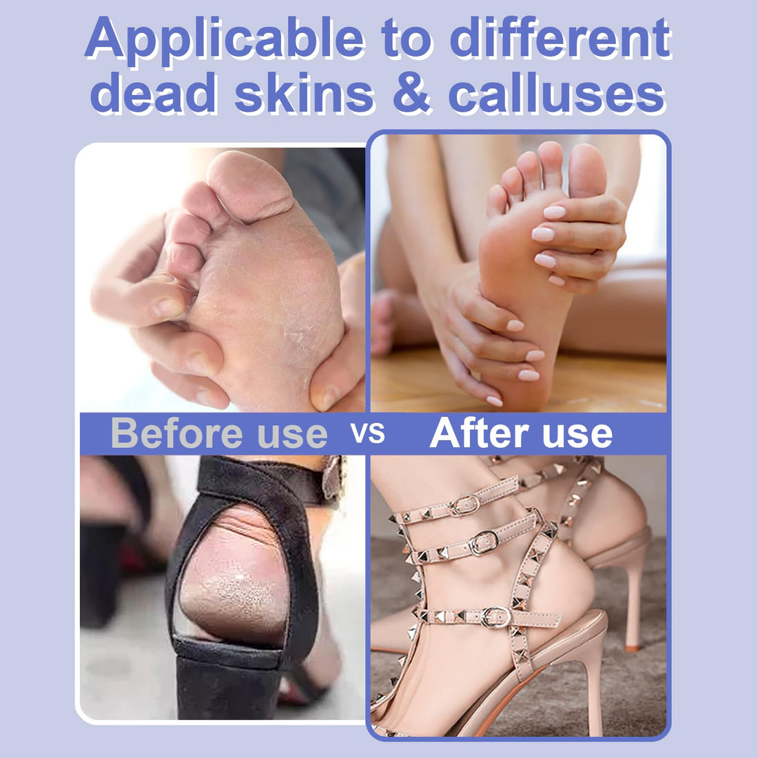 HayZBao Electric Foot File - High Torque,Callus Remover for Feet,Adjustable Speed Foot File with 60 Pcs Sandpaper Discs,Professional Pedicure Tool for Dead Skin and Calluses (Blue)