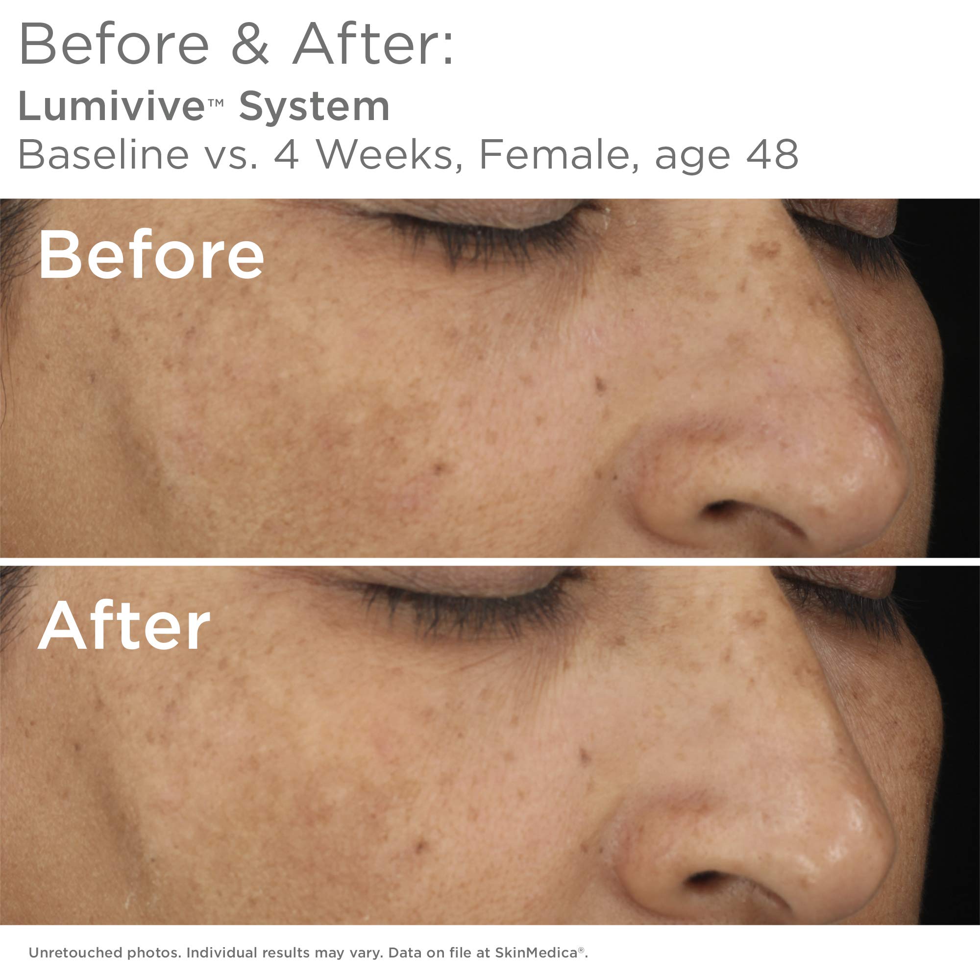 SkinMedica Lumivive Day & Night System Set