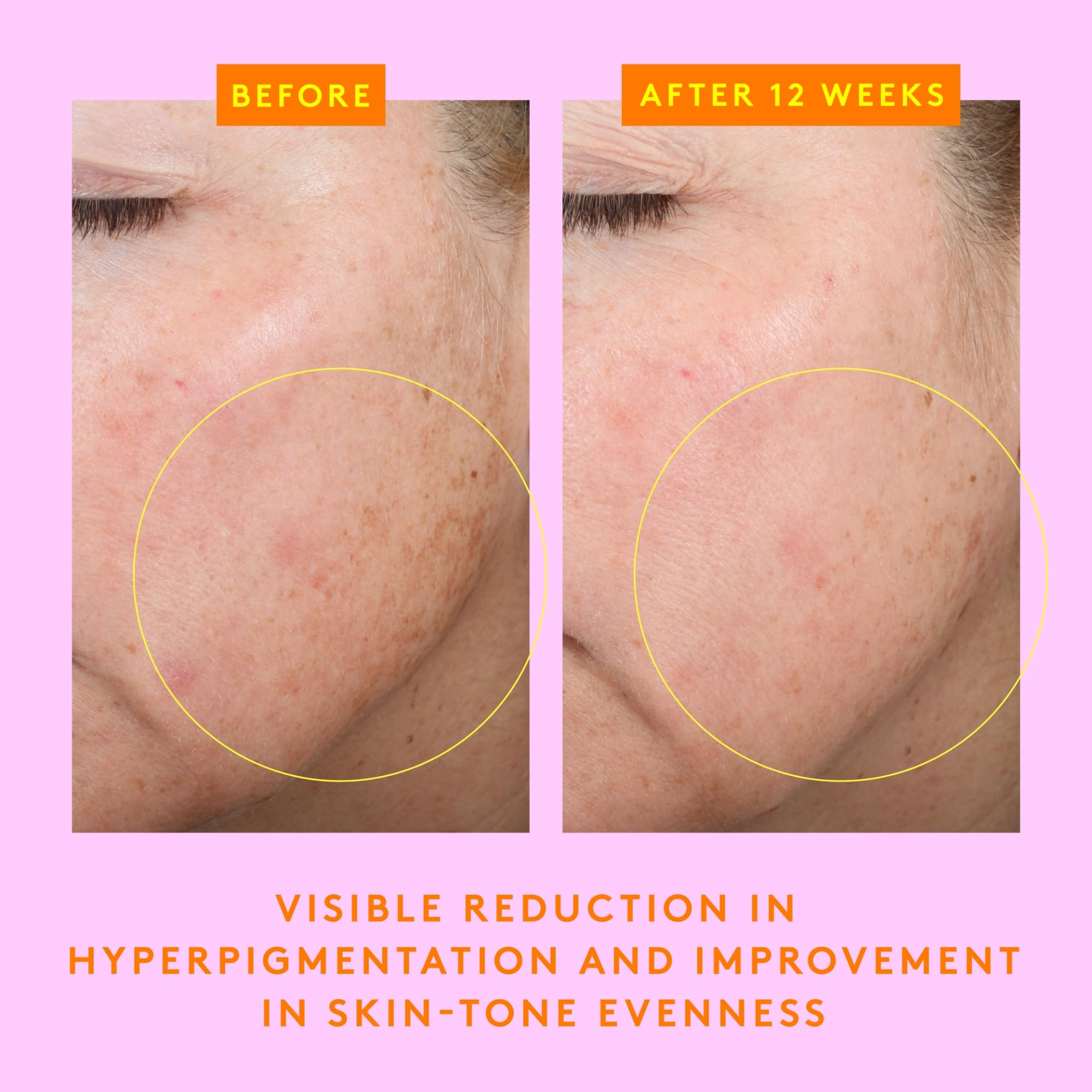 Drunk Elephant C-Firma Fresh Day Serum - 28 ml/.94 fl oz - 15% Illuminating Vitamin C - Clean Clinical Skincare - Cruelty-Free - Dermatologist-Tested - Free of Essential Oils, Silicones, and Fragrance