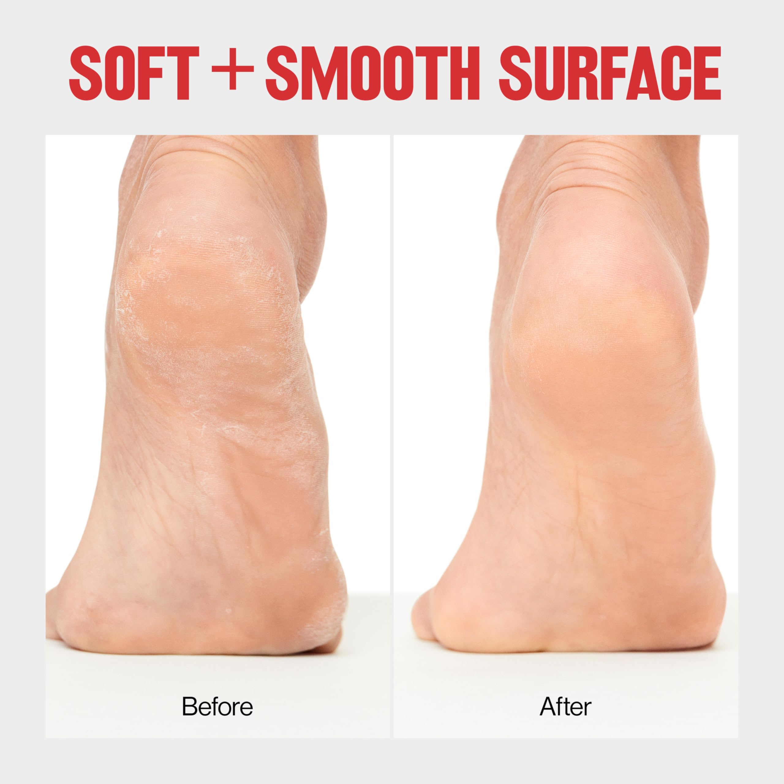 Revlon Callus Remover, Foot File with No-Mess Cover, Gently Exfoliates and Smooths Feet, Softens Calloused Areas, 1 count